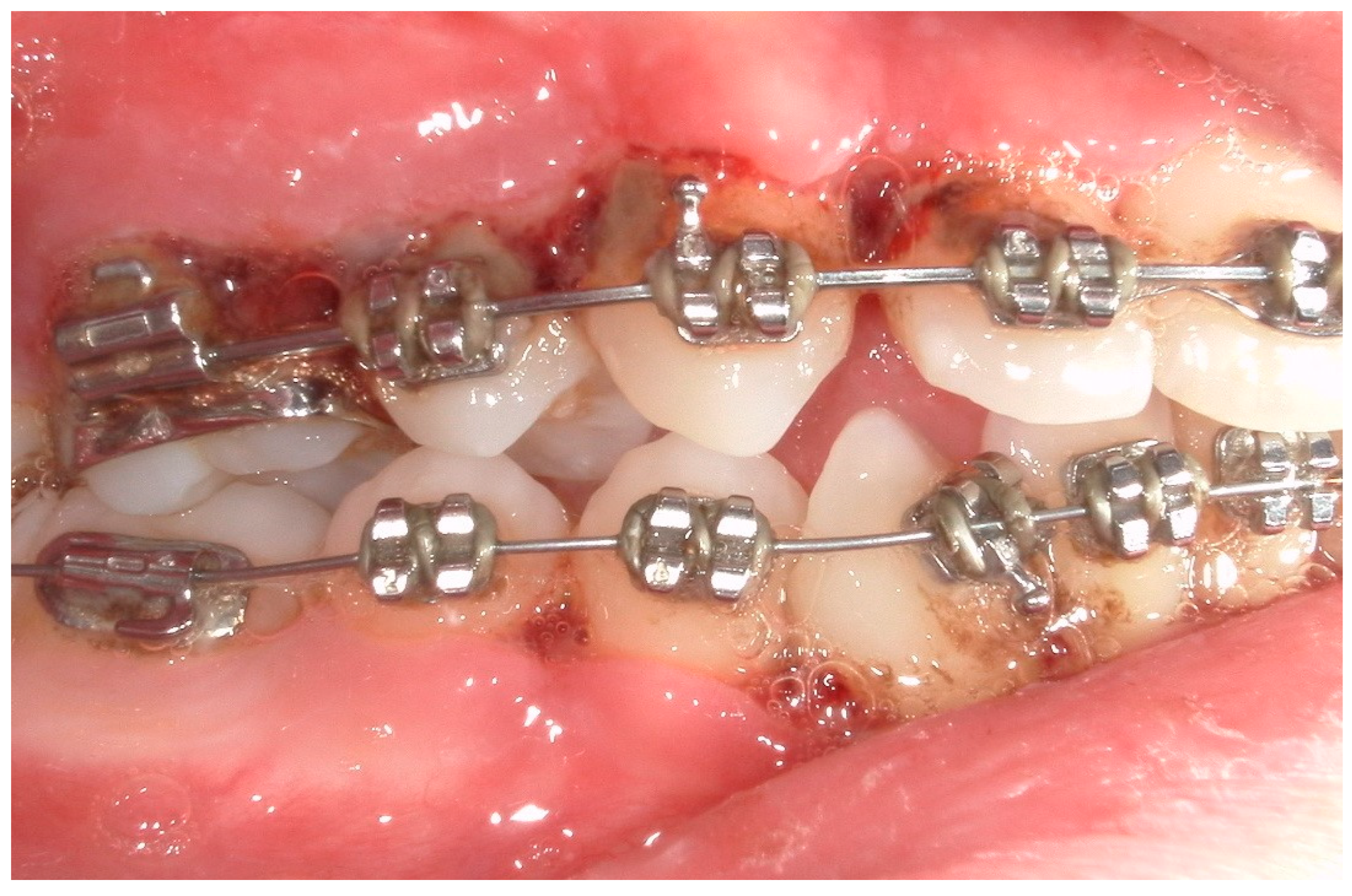 Children 11 01019 g009