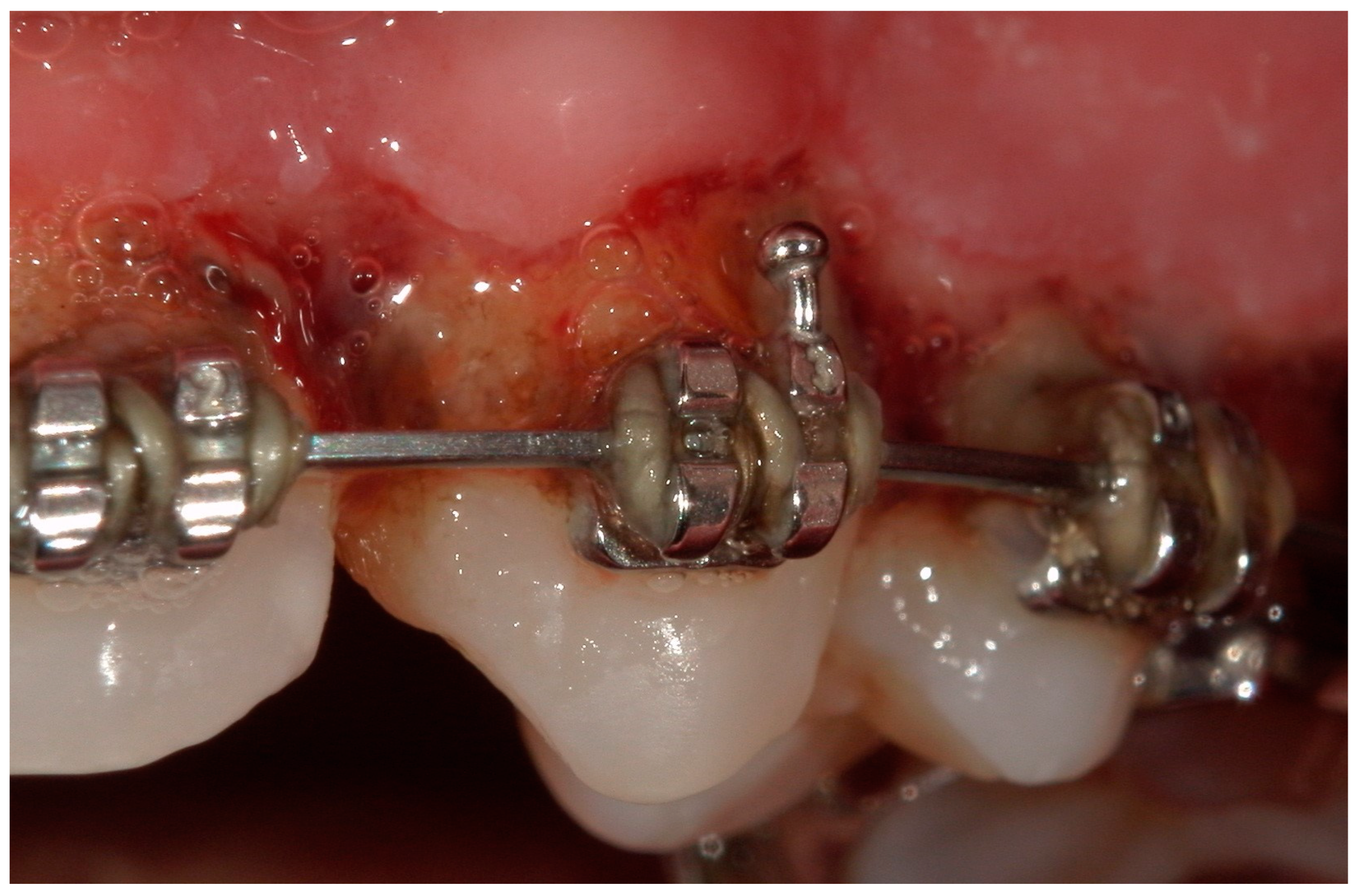 Children 11 01019 g010