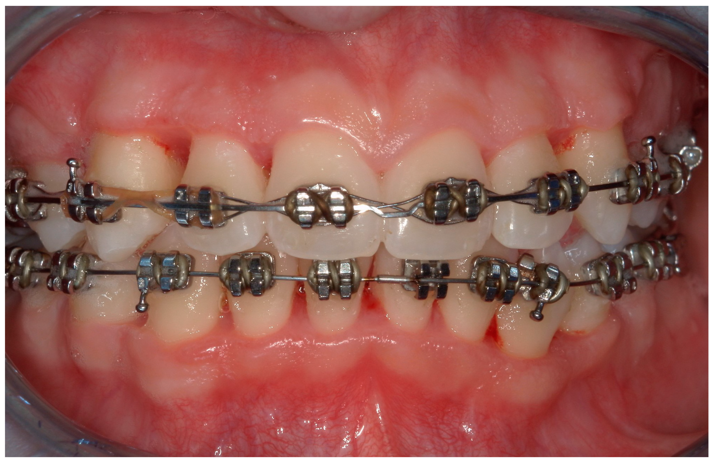 Children 11 01019 g011