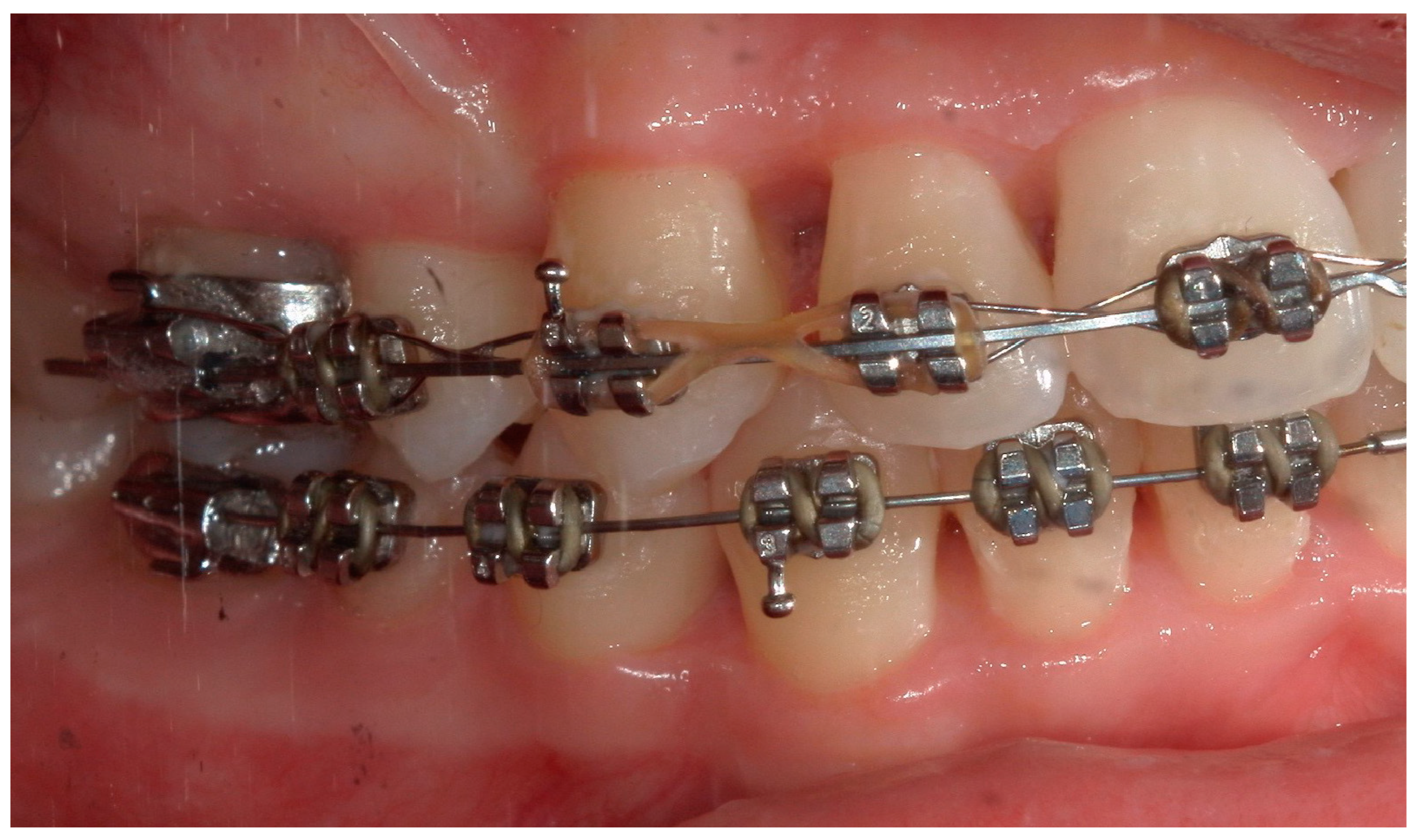 Children 11 01019 g015