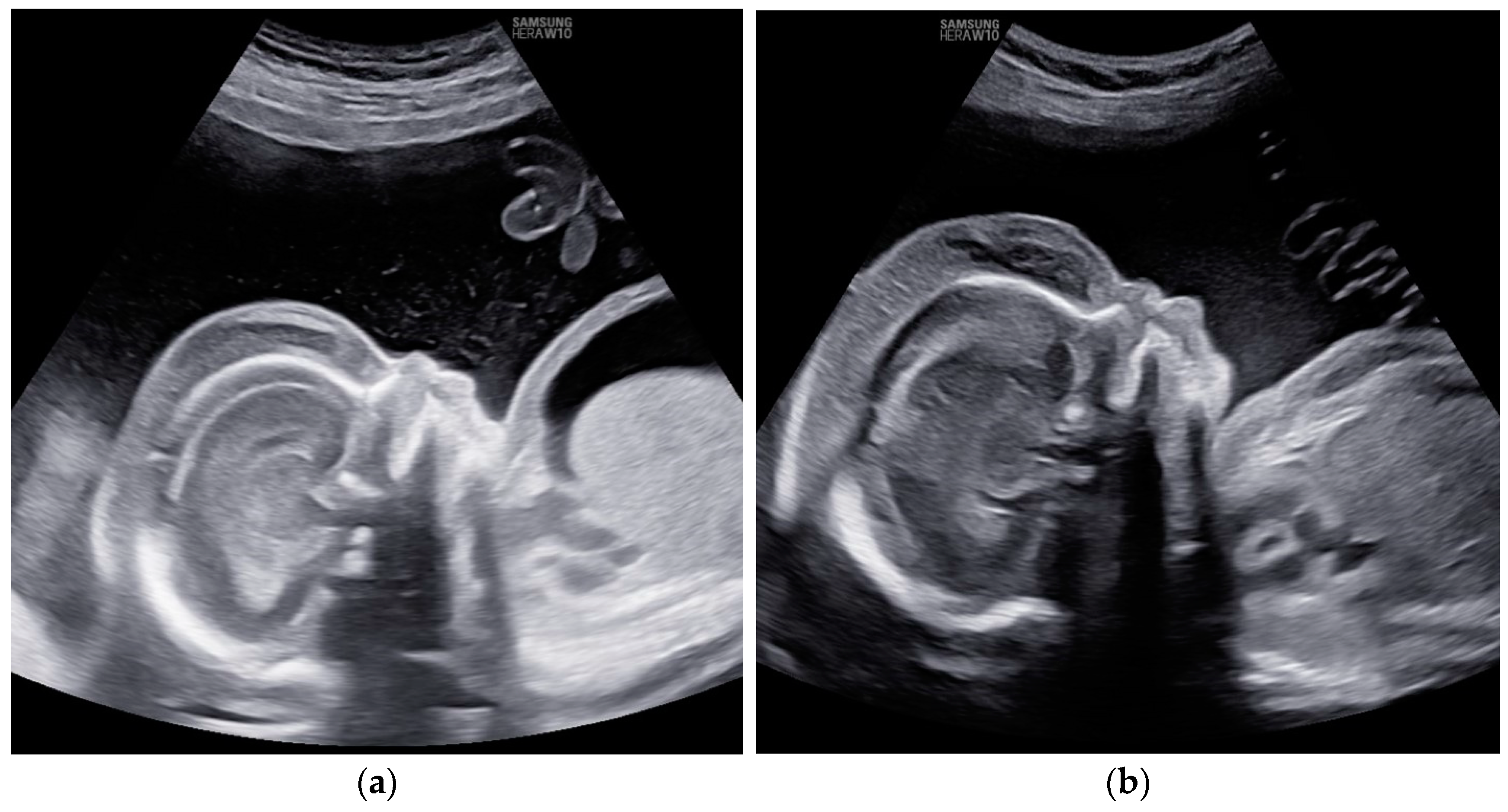 Children 11 01037 g002