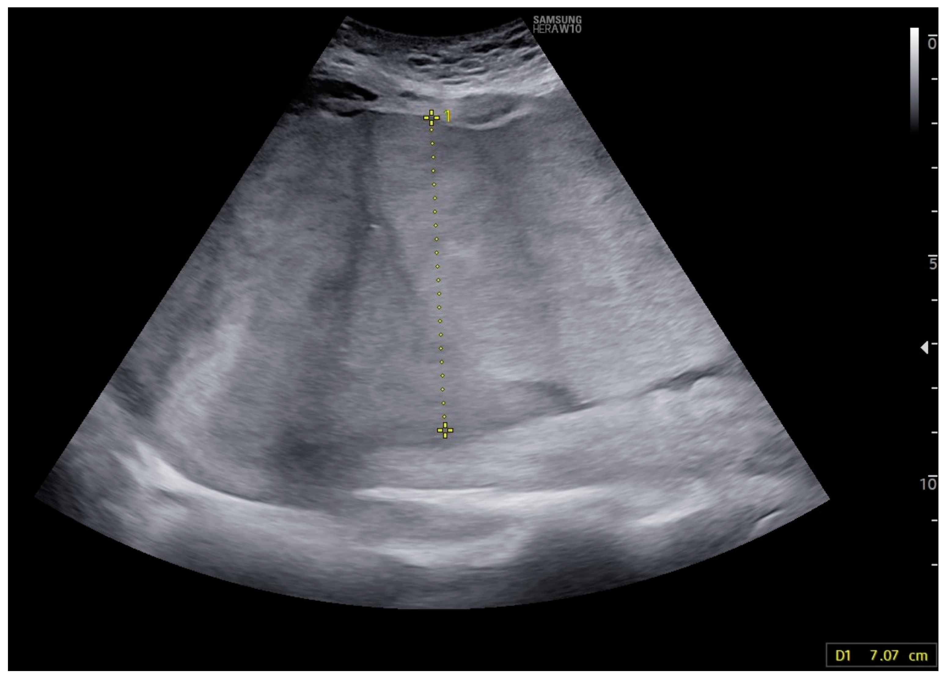 Children 11 01037 g003