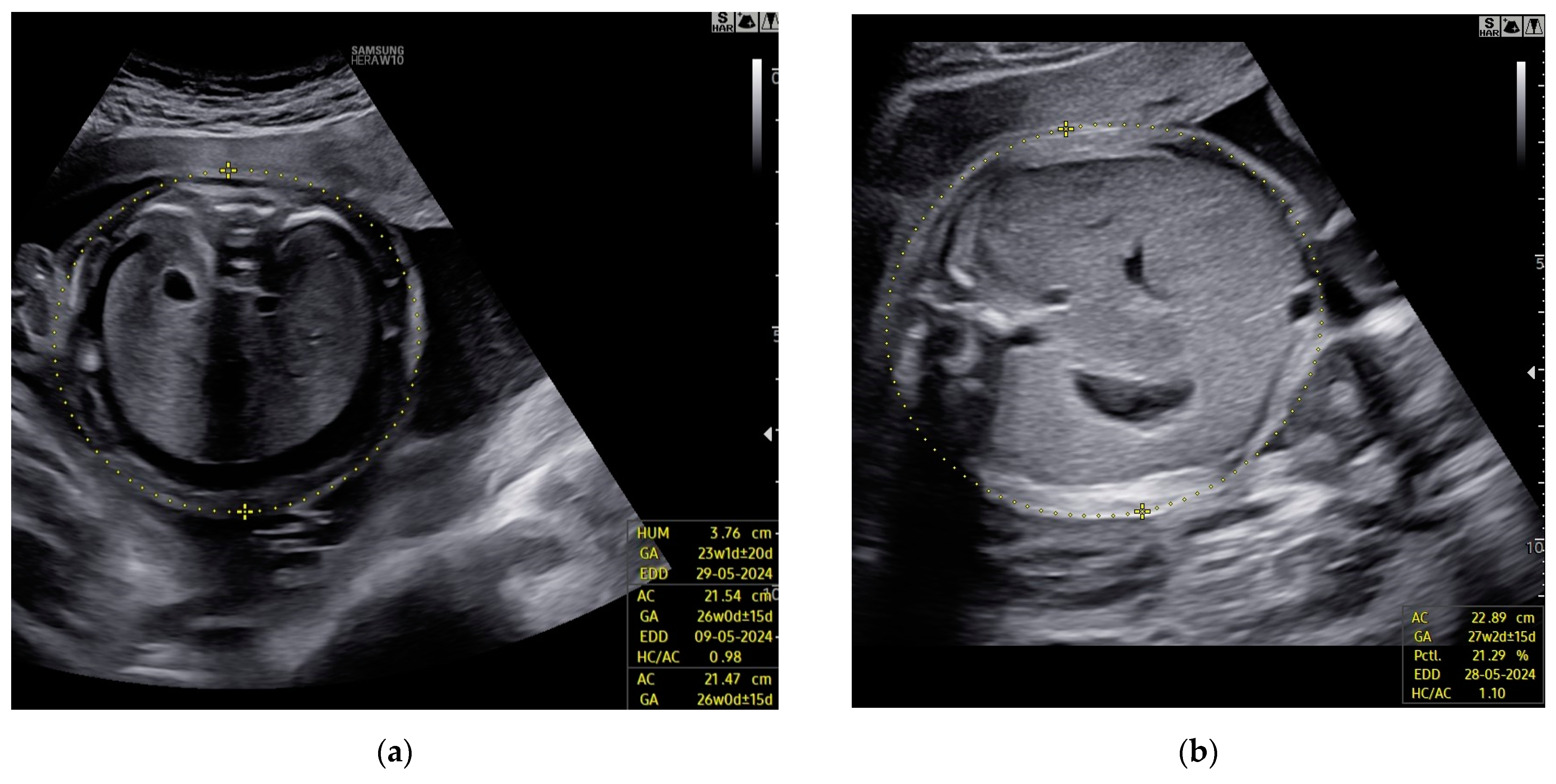 Children 11 01037 g006