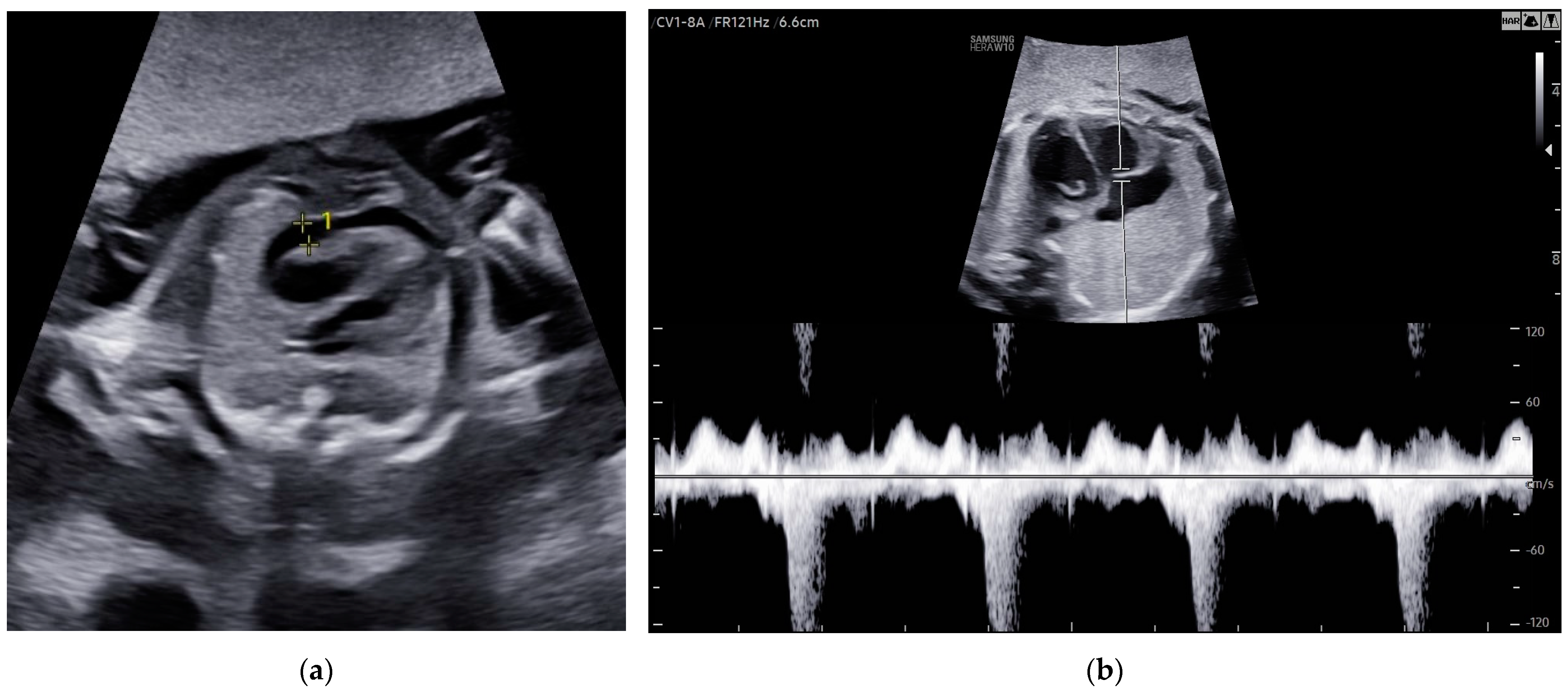 Children 11 01037 g007