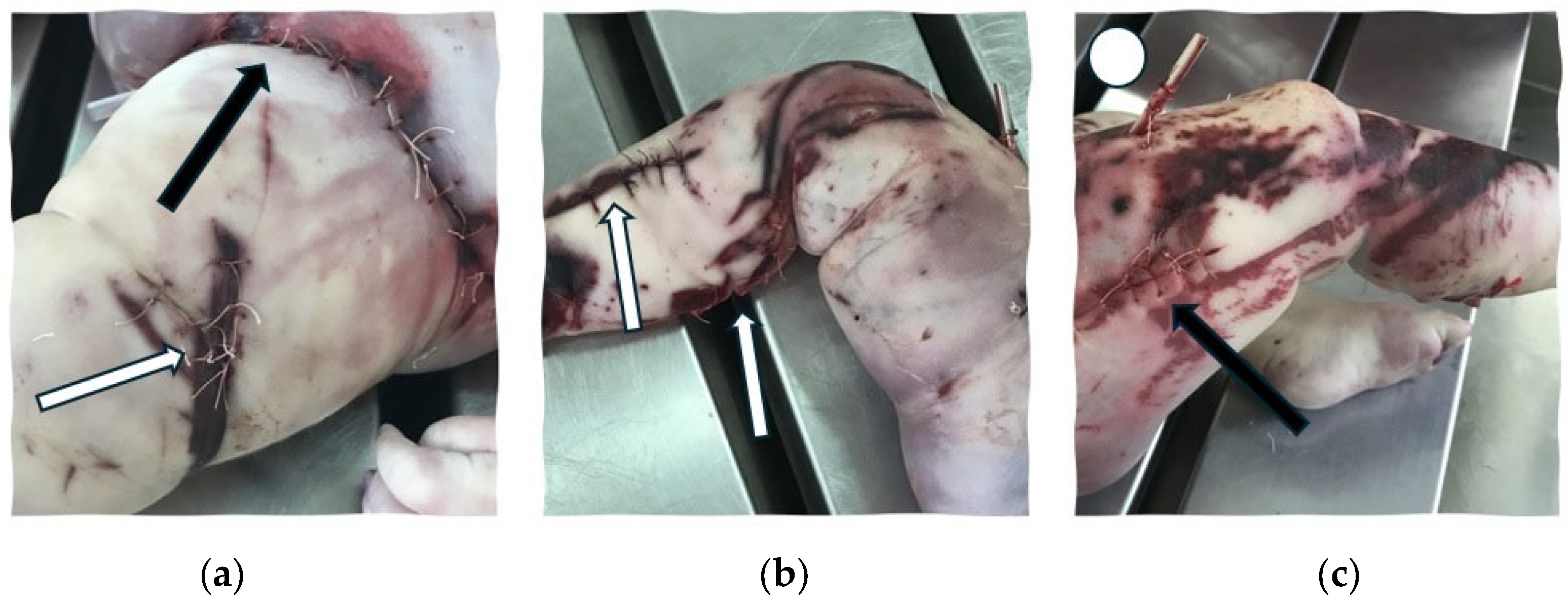autopsy child  
