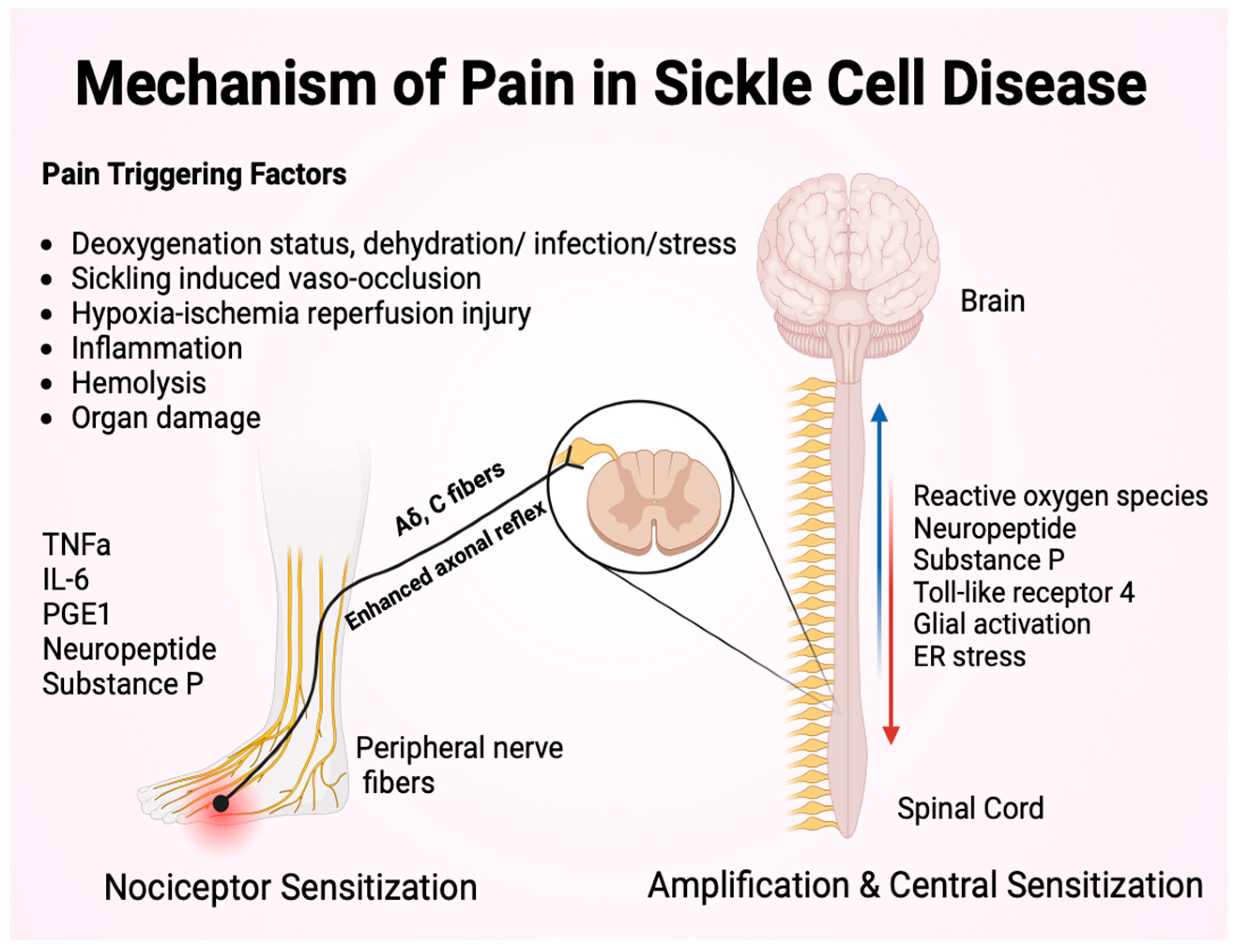 Inpatient Management of Pain Episodes in Children with Sickle Cell 