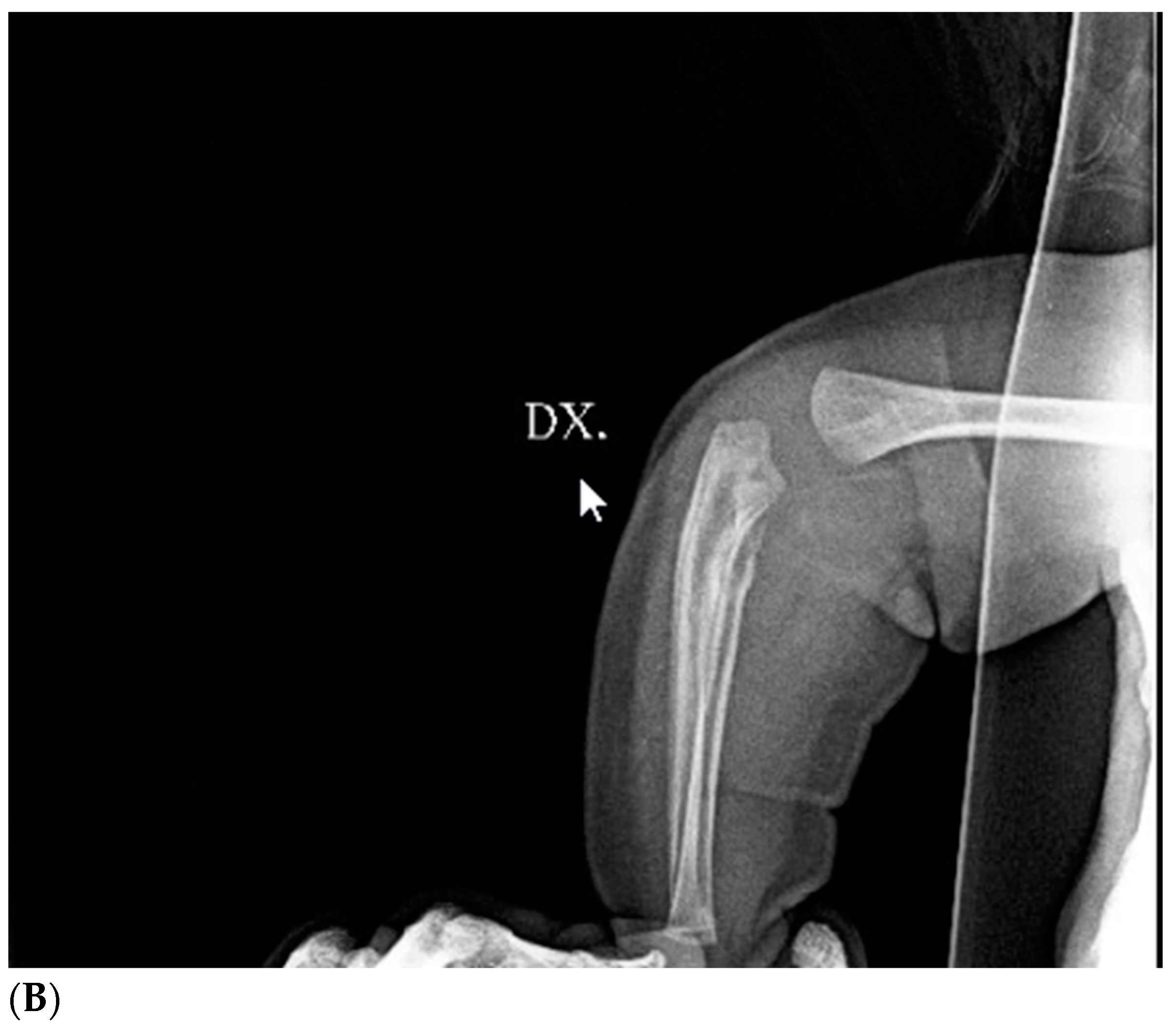 Children 11 01126 g003b