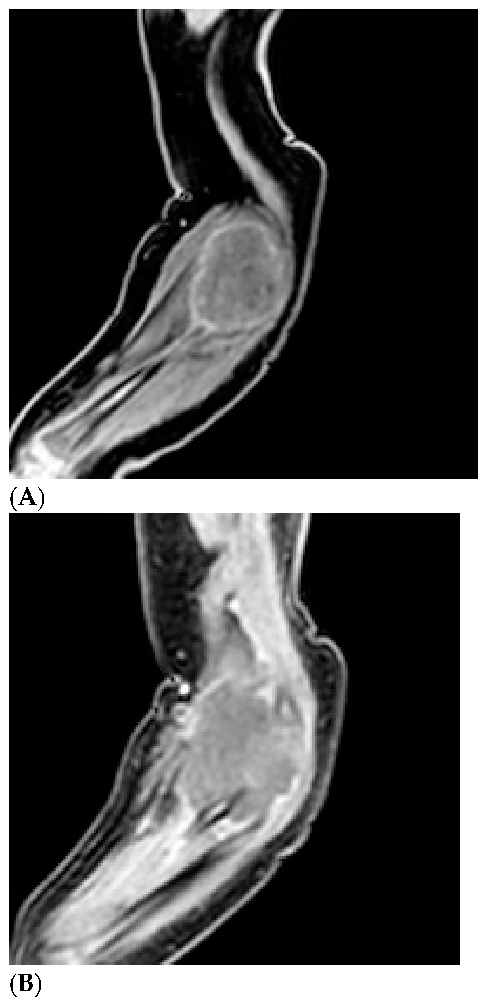 Children 11 01126 g004