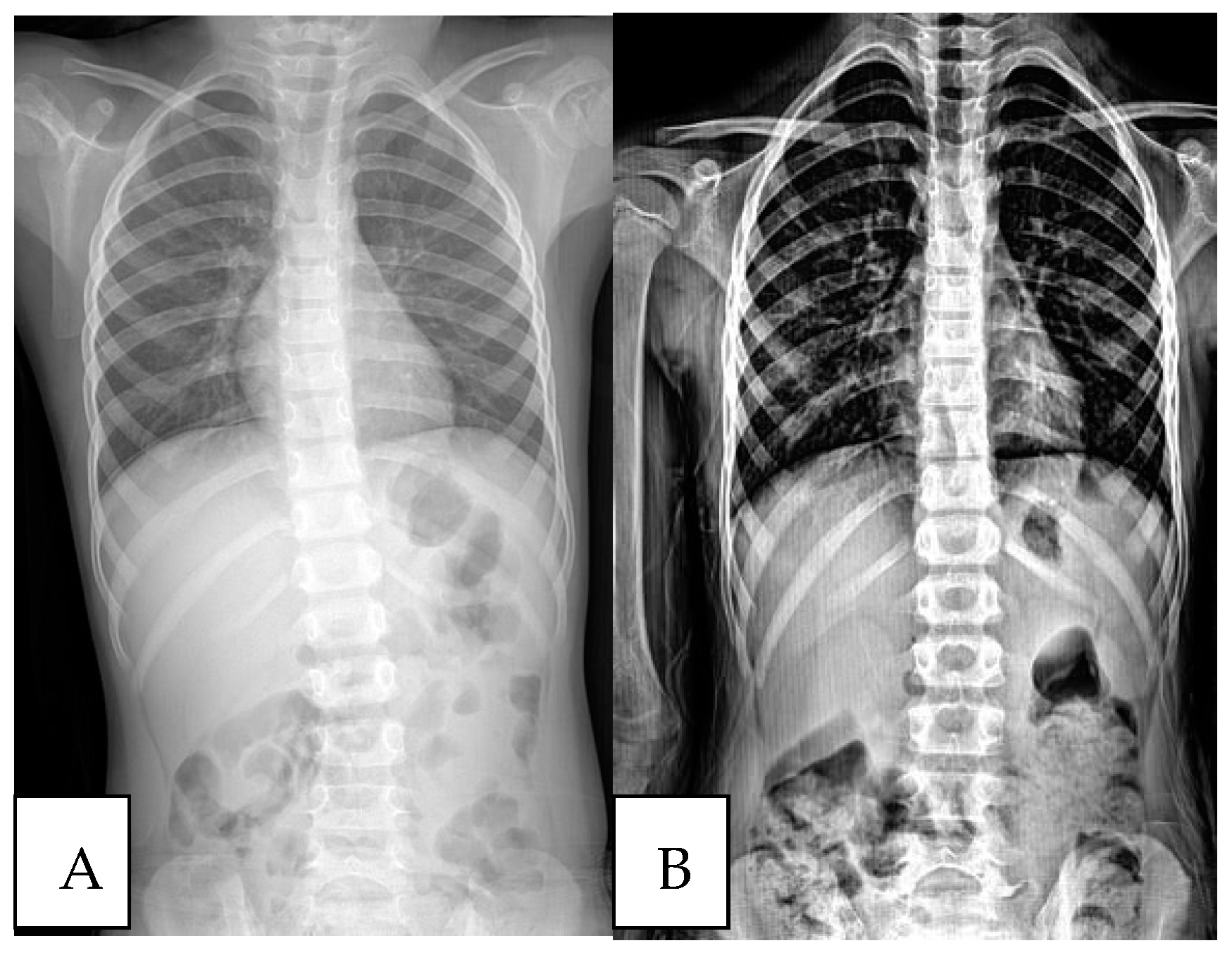 Children 11 01134 g003