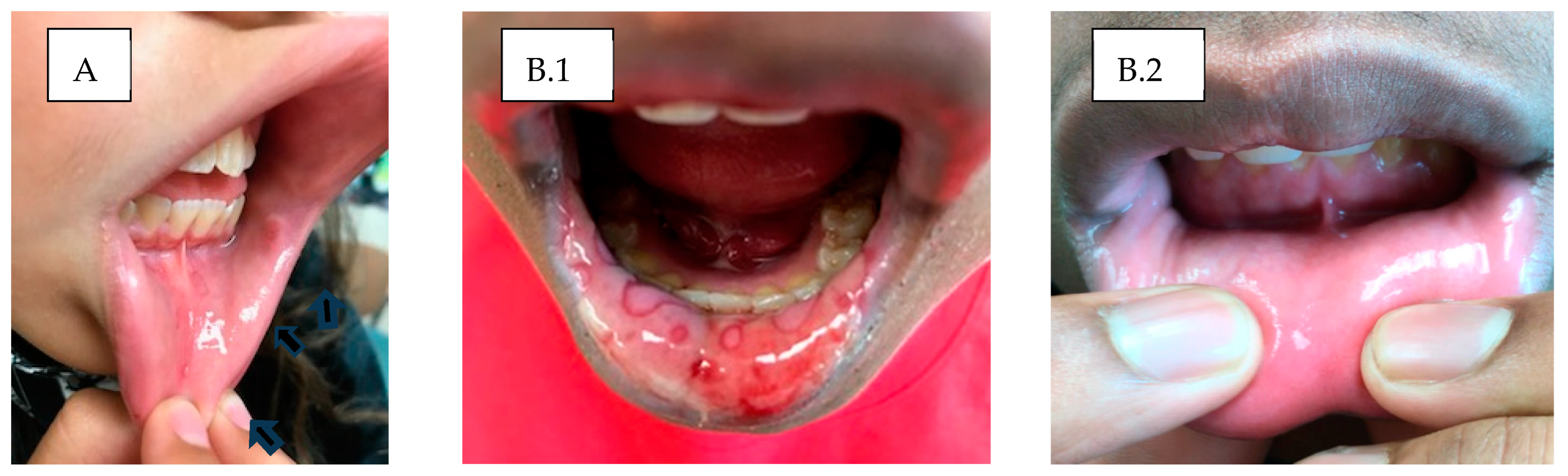 Children 11 01146 g002 Children 11 01146 g002