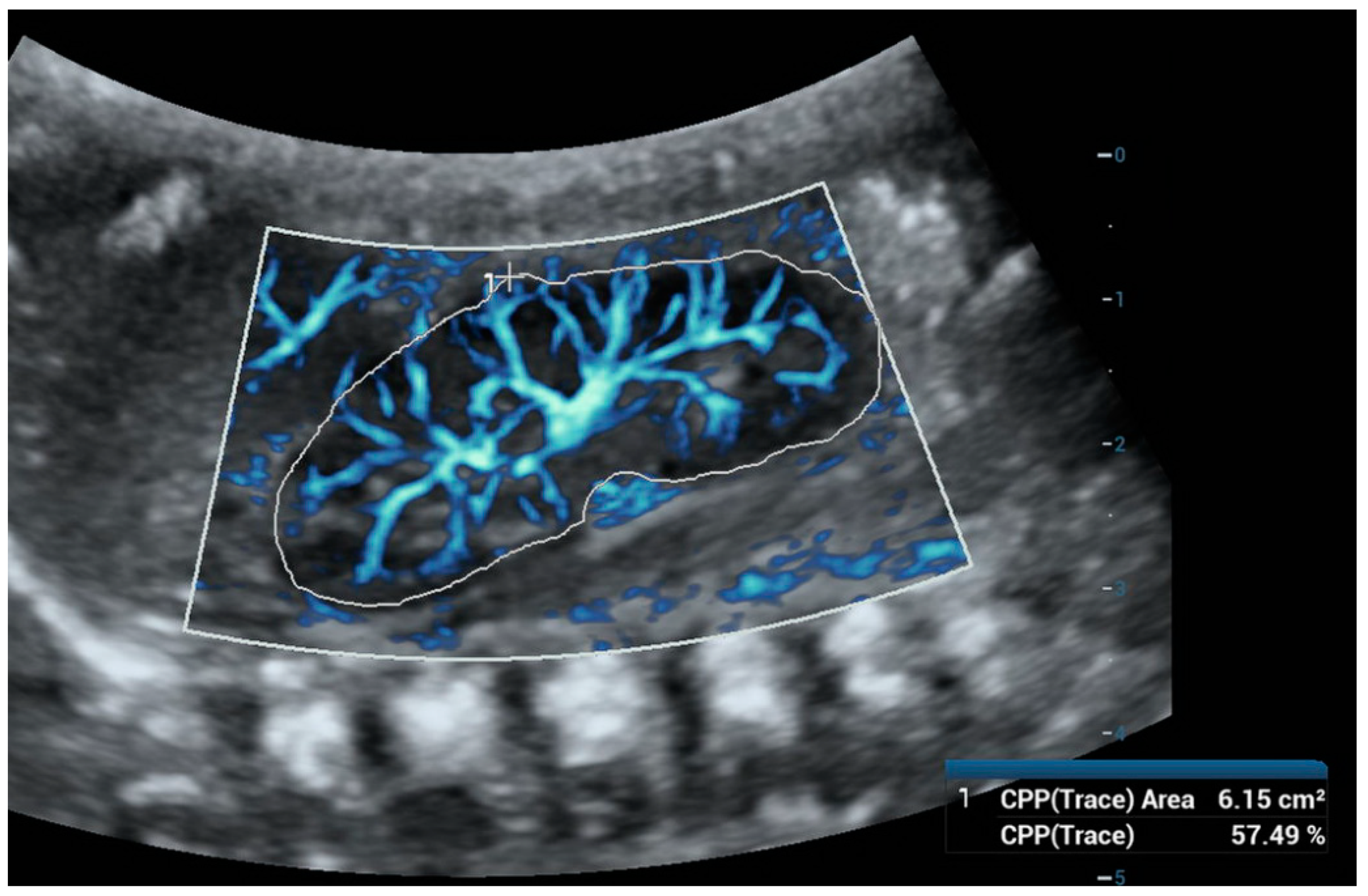 Children 11 01205 g003