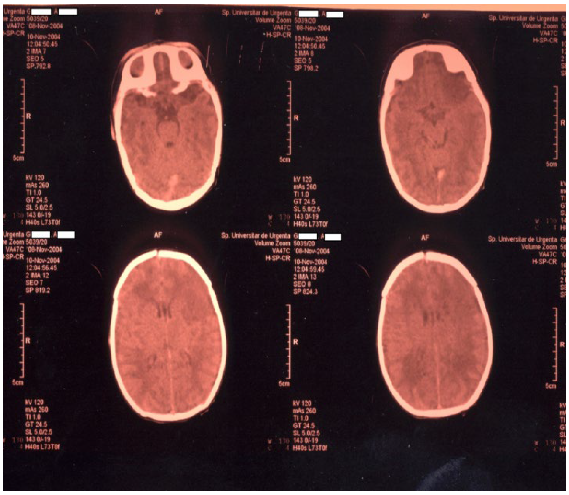 Children 11 01214 g001