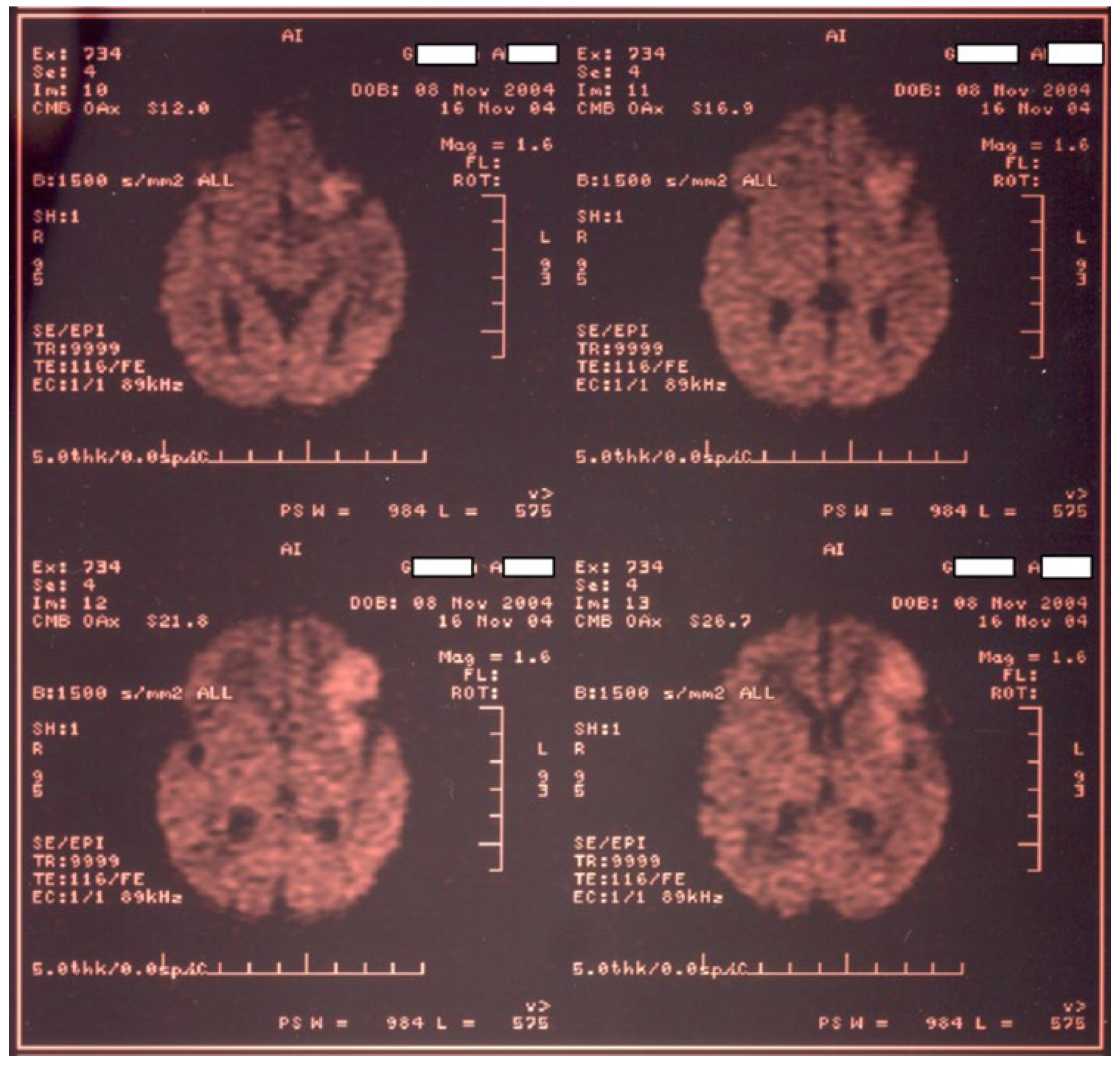 Children 11 01214 g002