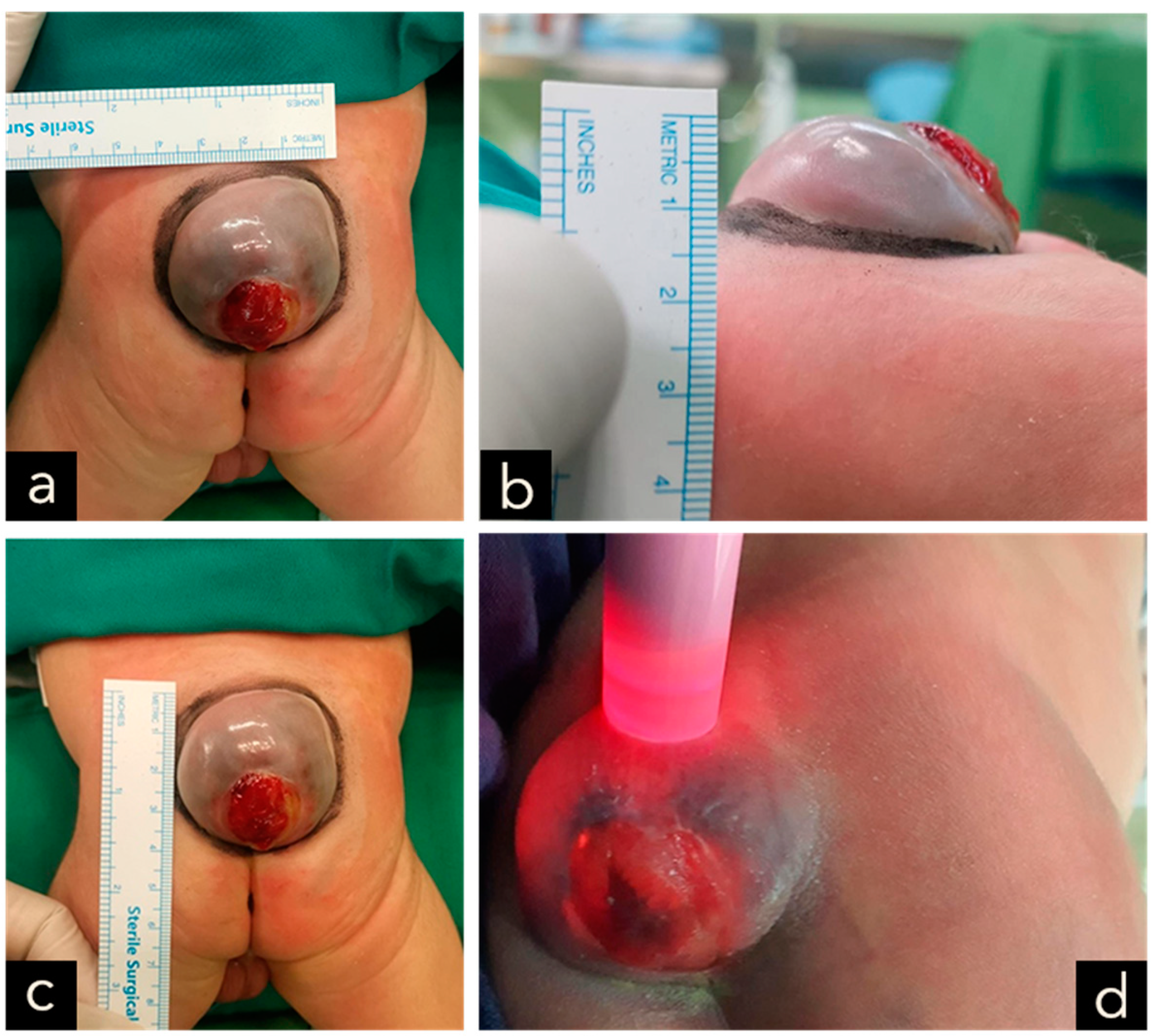 Children 11 01219 g001 Children 11 01219 g001