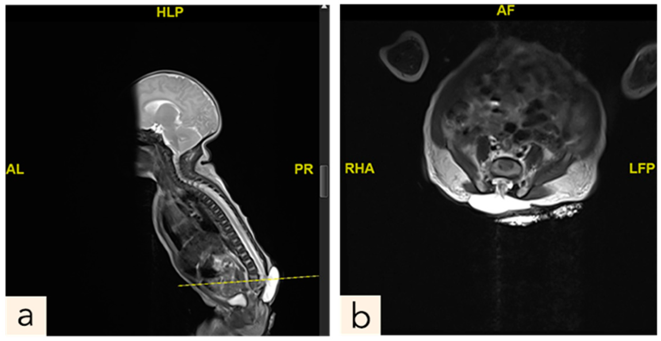 Children 11 01219 g002 Children 11 01219 g002