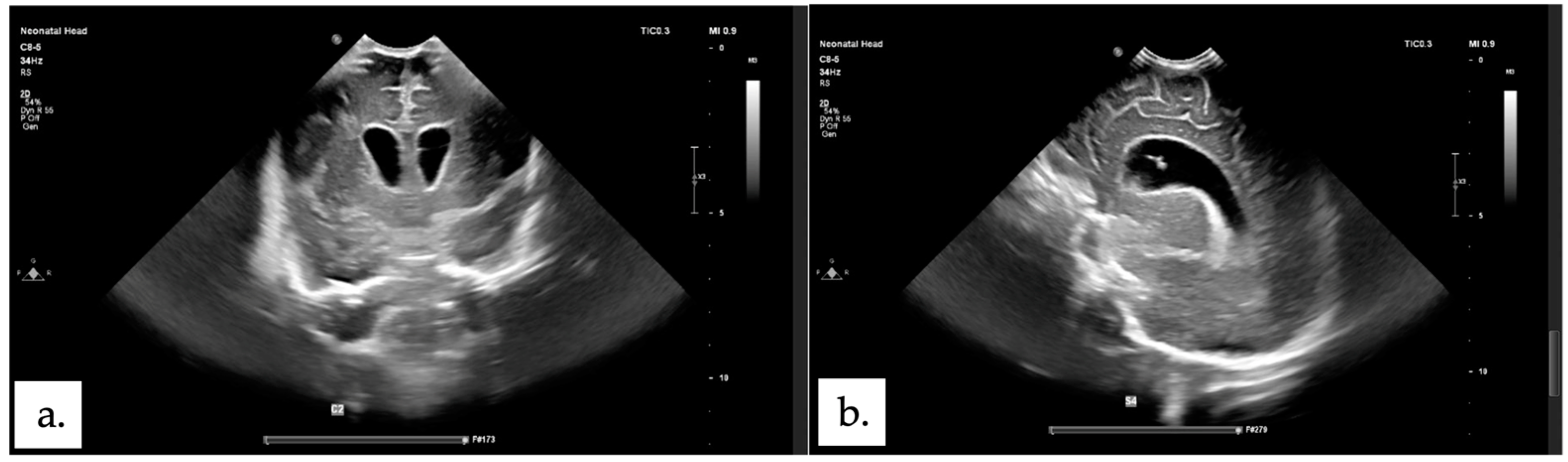 Children 11 01219 g003 Children 11 01219 g003