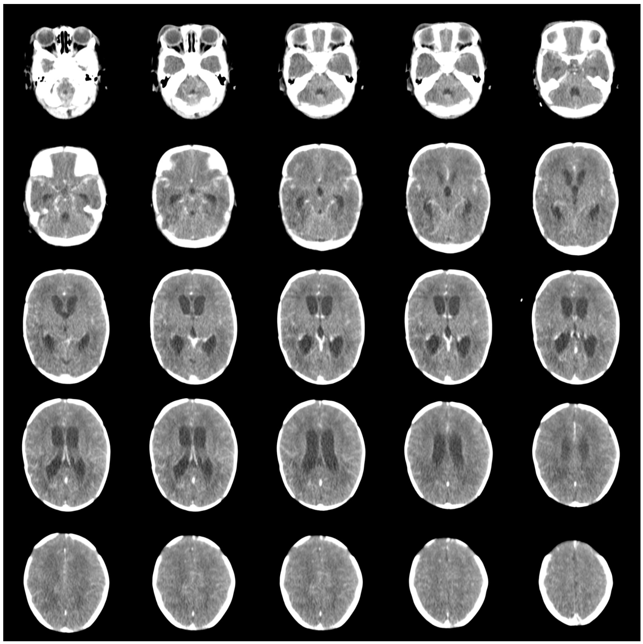 Children 11 01219 g004 Children 11 01219 g004