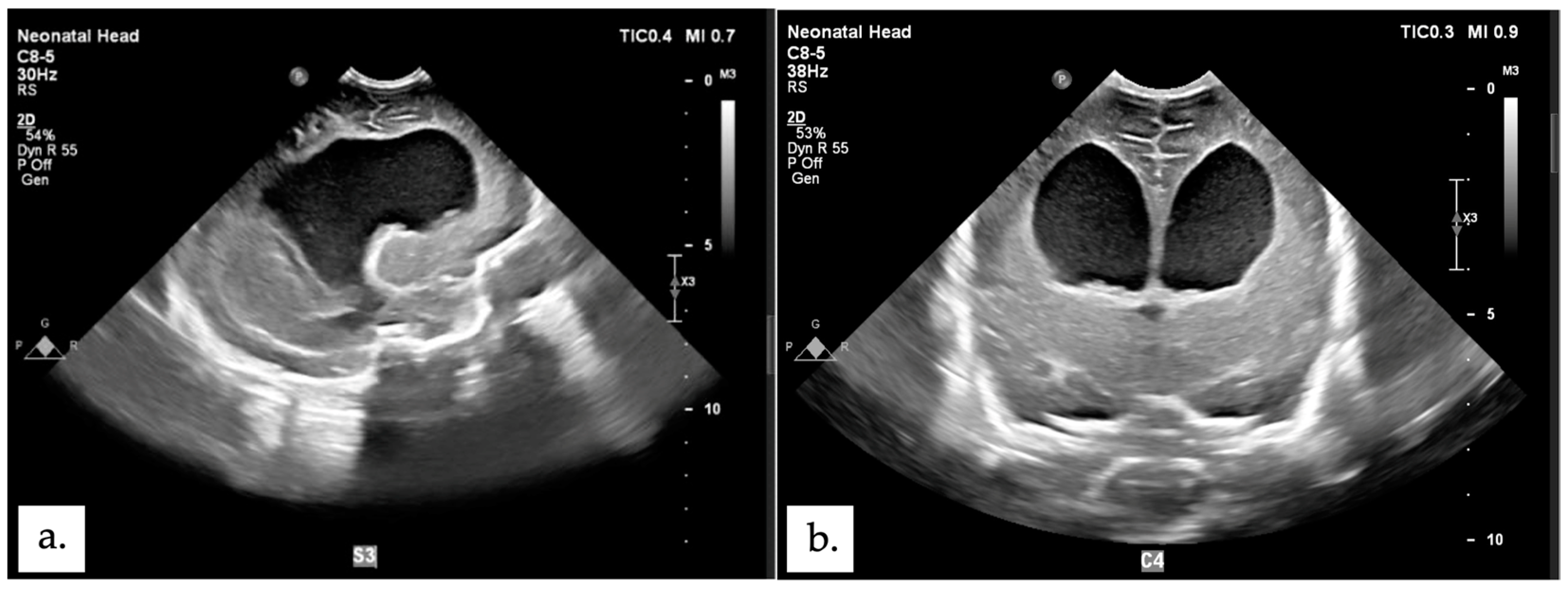 Children 11 01219 g006 Children 11 01219 g006