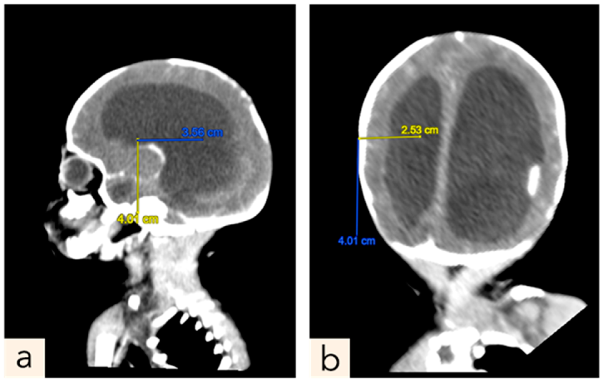 Children 11 01219 g007 Children 11 01219 g007