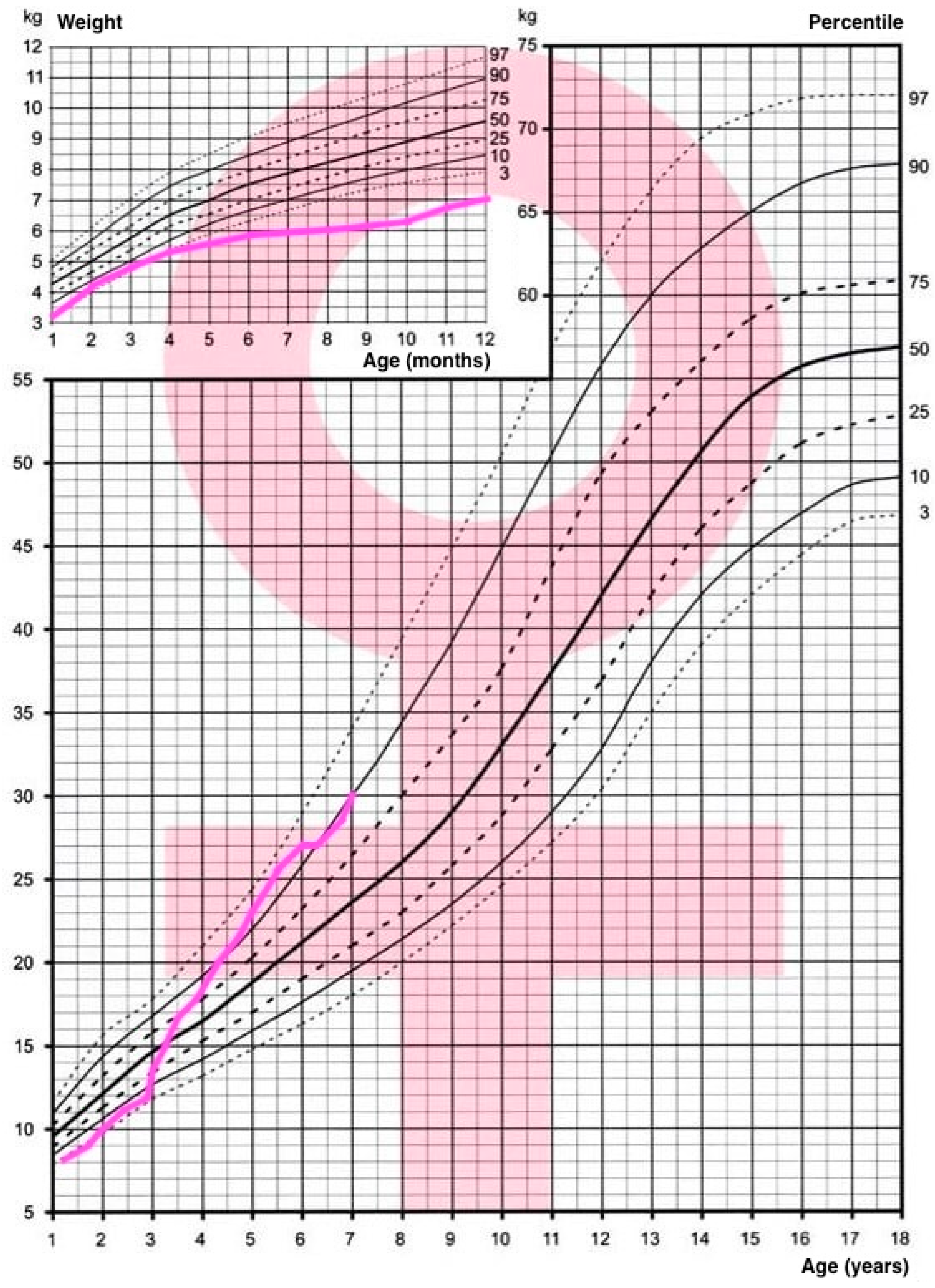 Children 11 01231 g005 Children 11 01231 g005