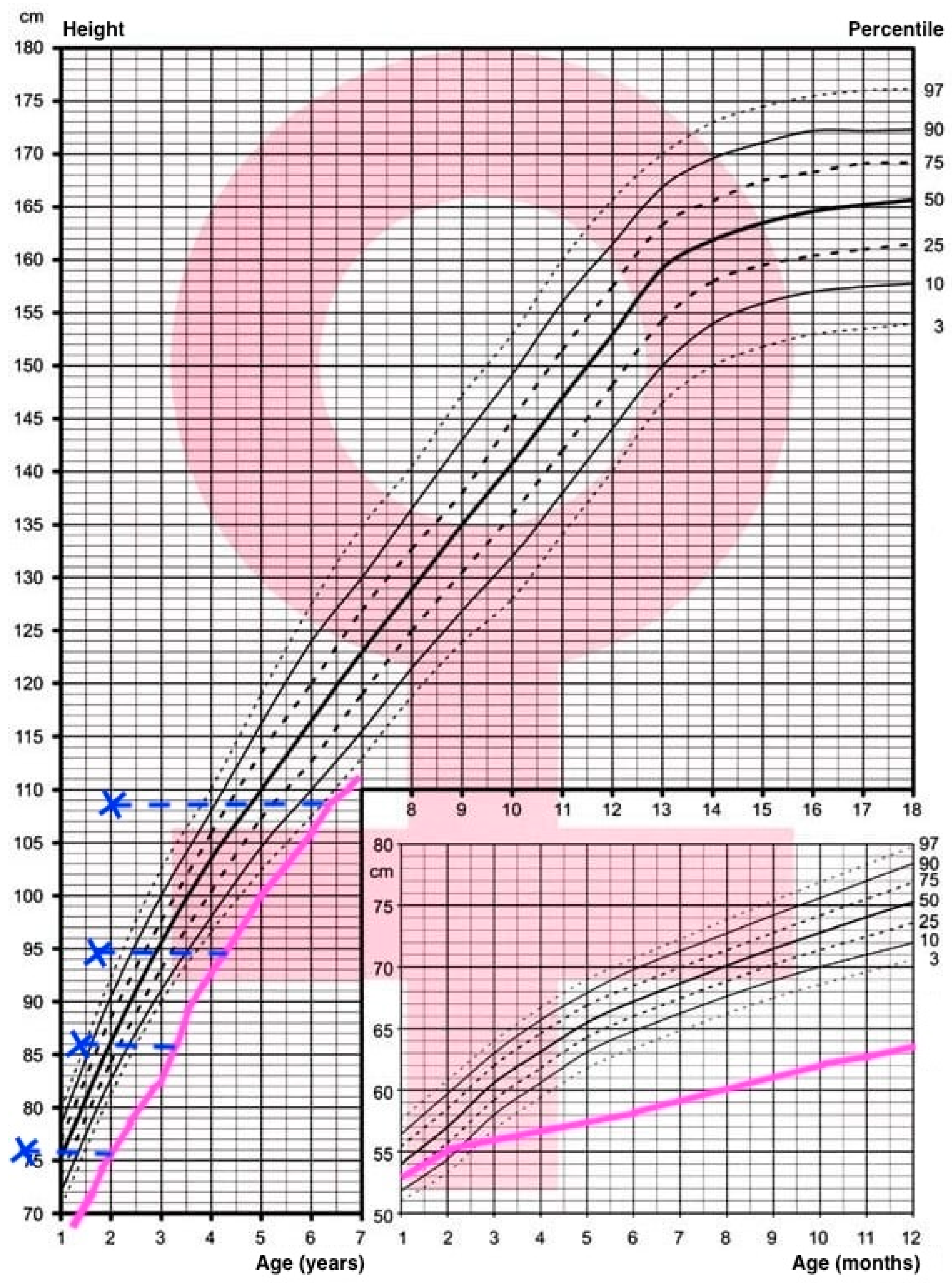 Children 11 01231 g006 Children 11 01231 g006