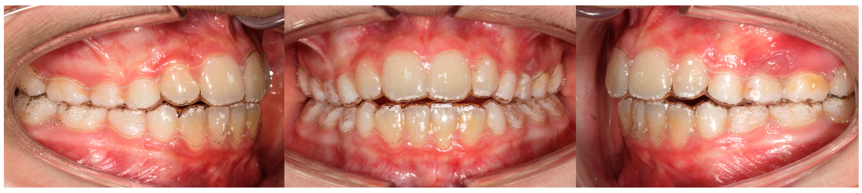 Children 11 01252 g001