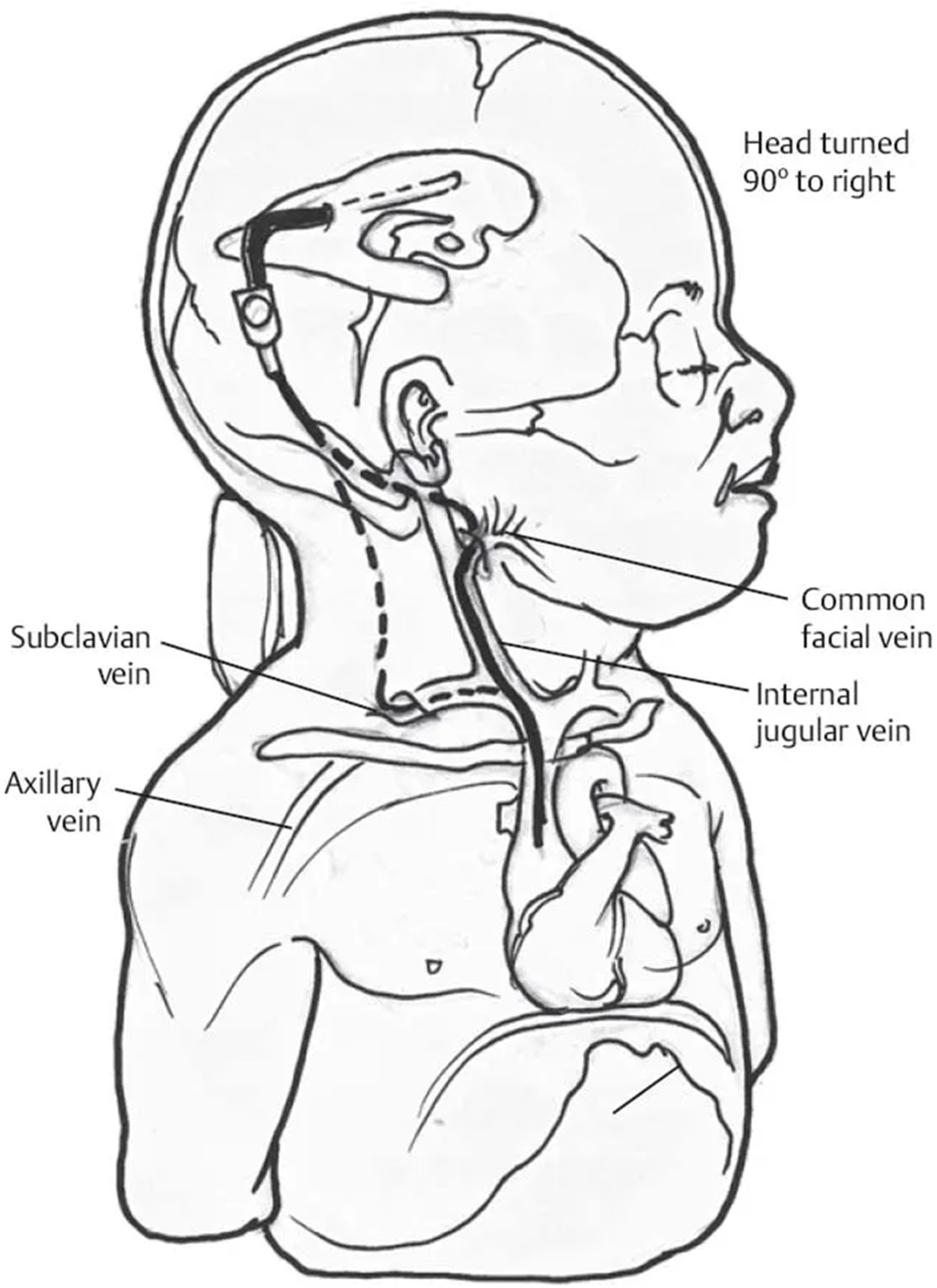 Children 11 01334 g003