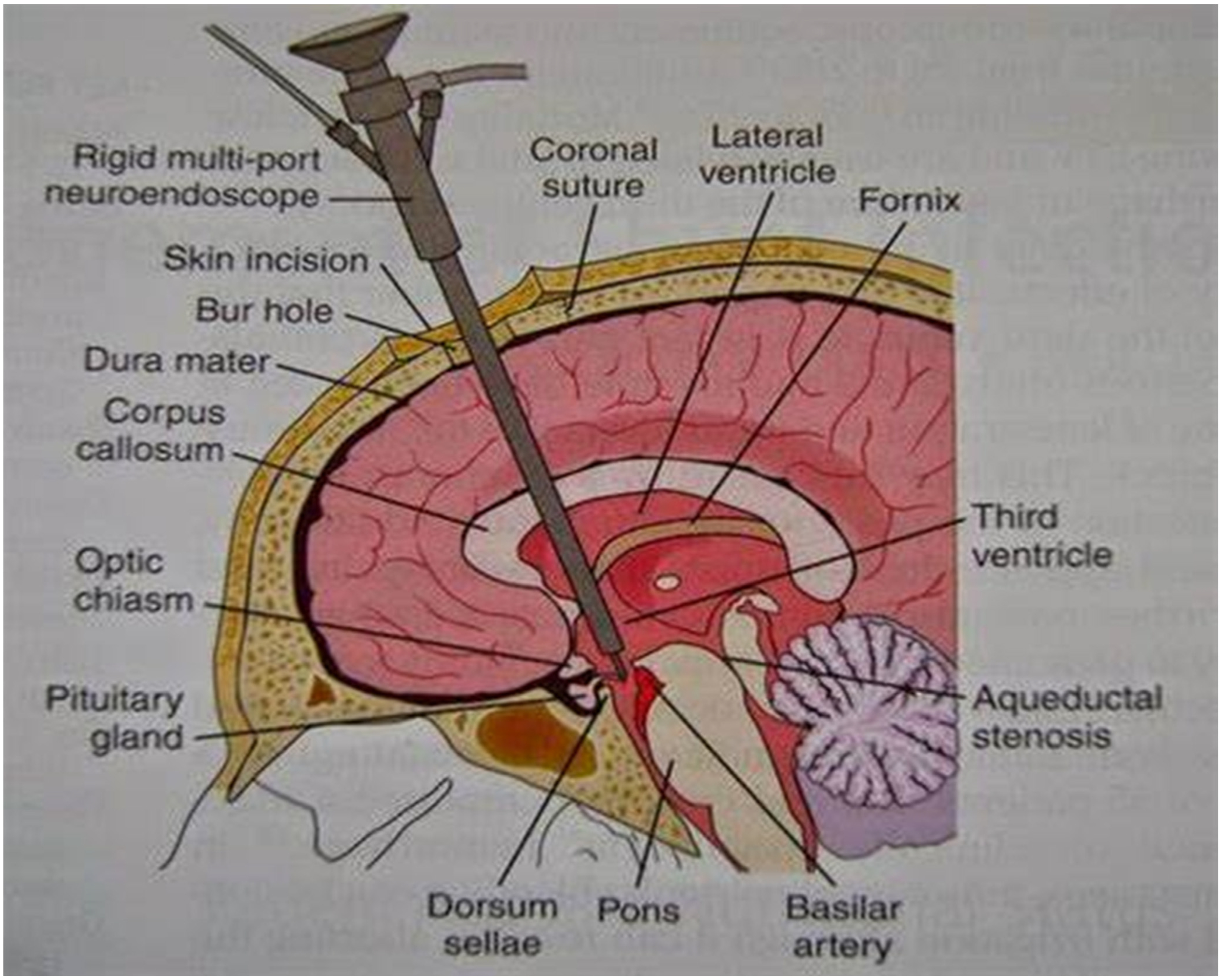 Children 11 01334 g004