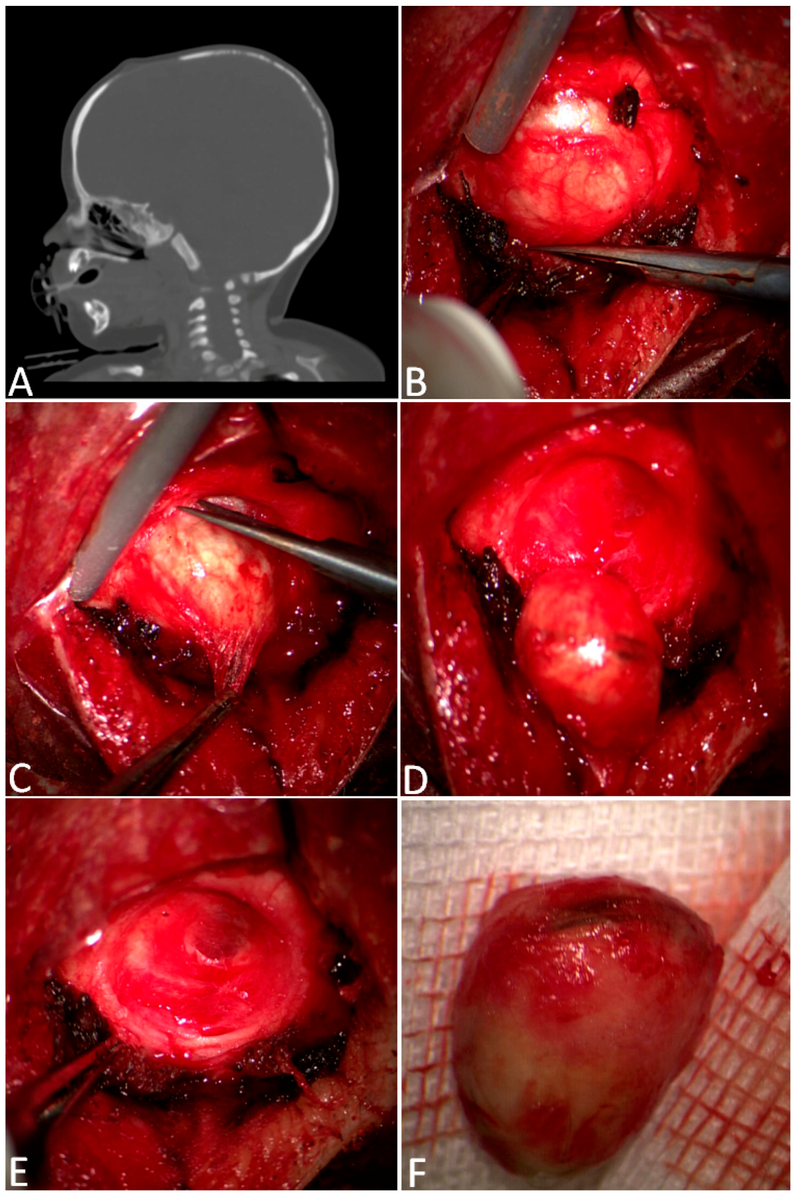 Children 11 01377 g002