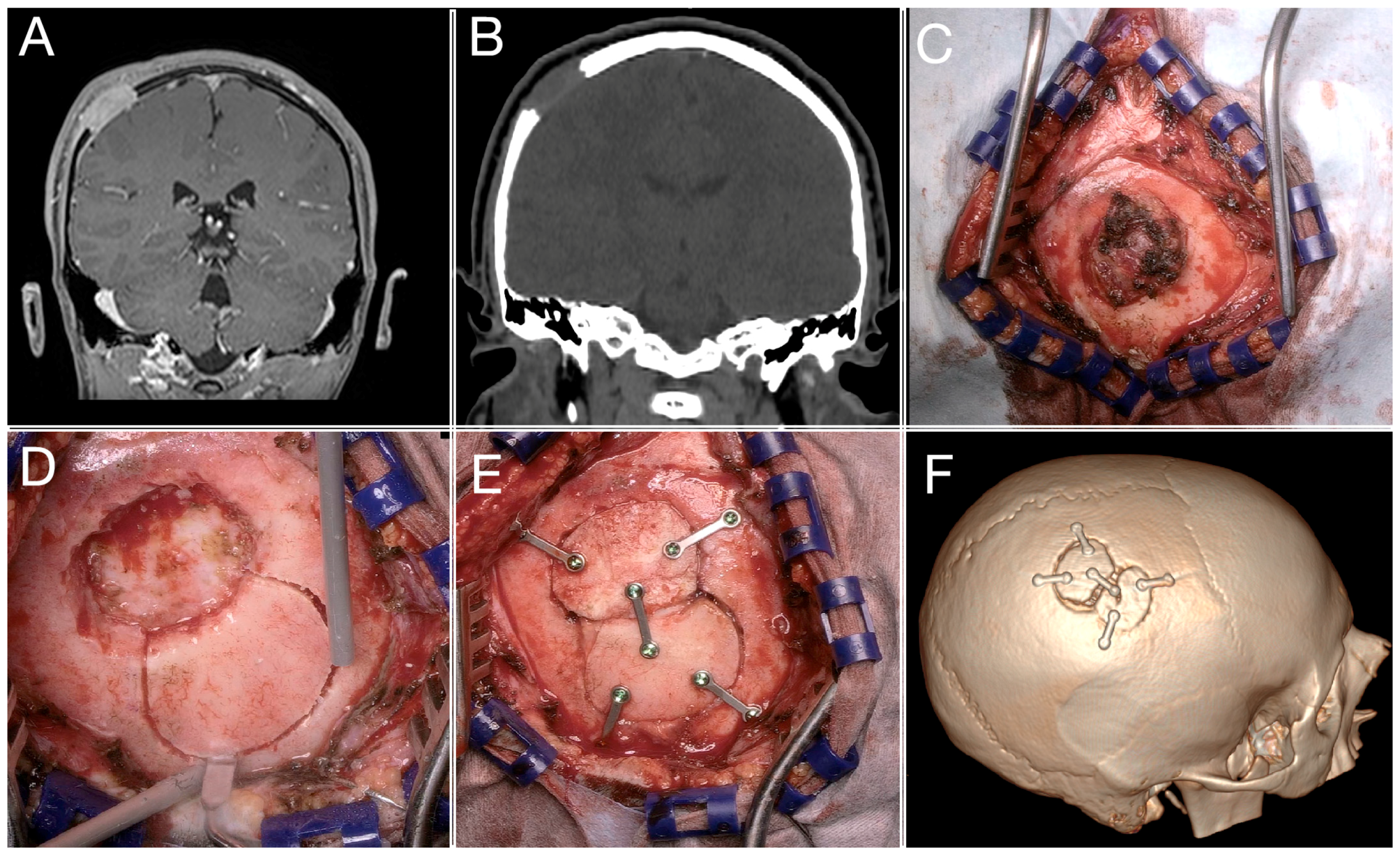 Children 11 01377 g003