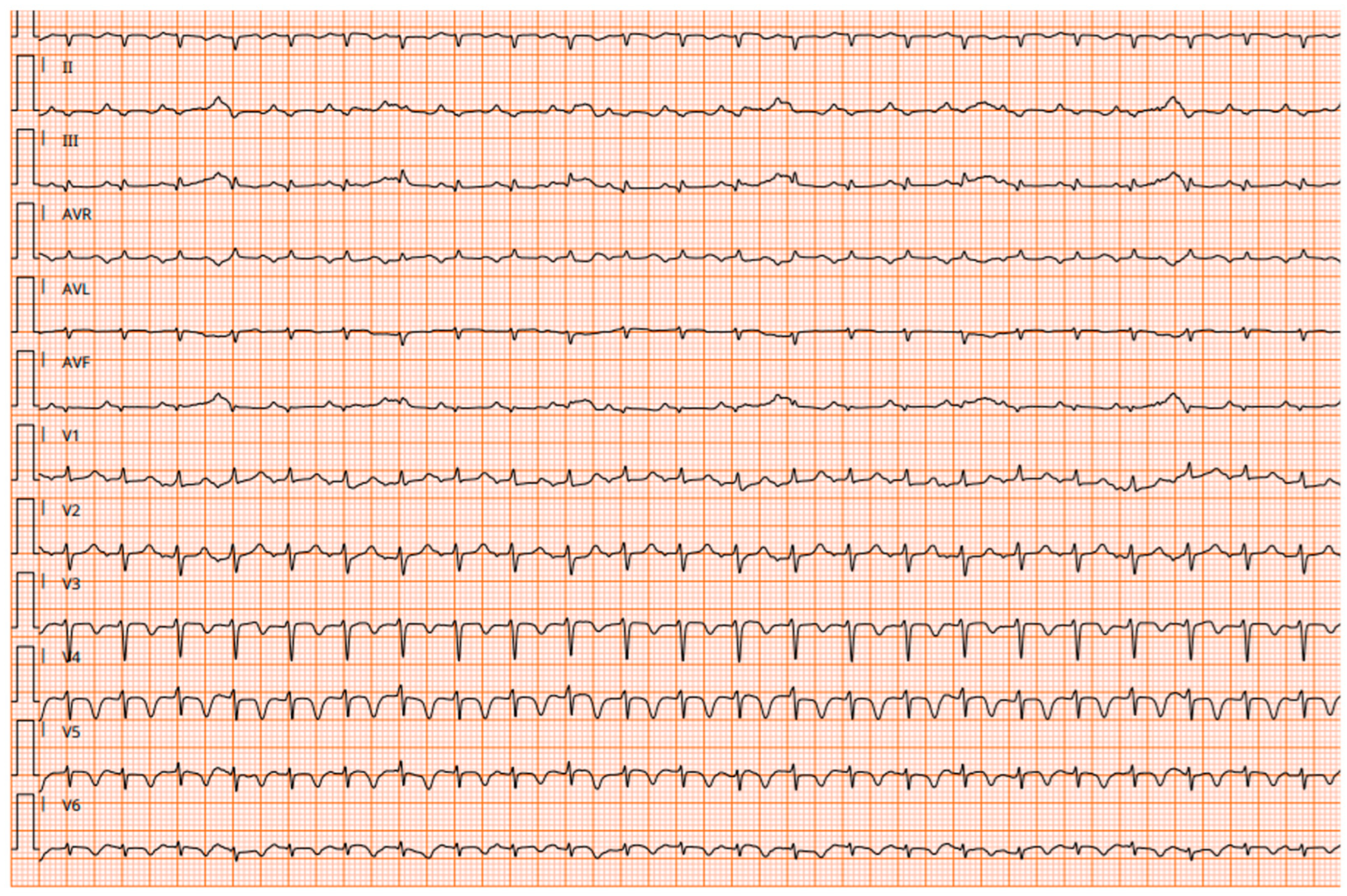 Children 11 01414 g001