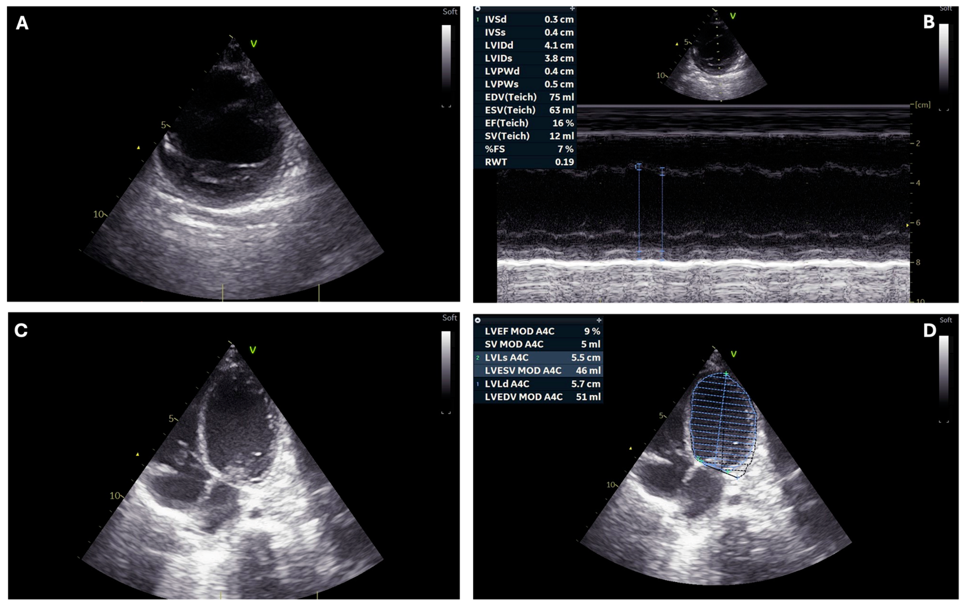 Children 11 01414 g002