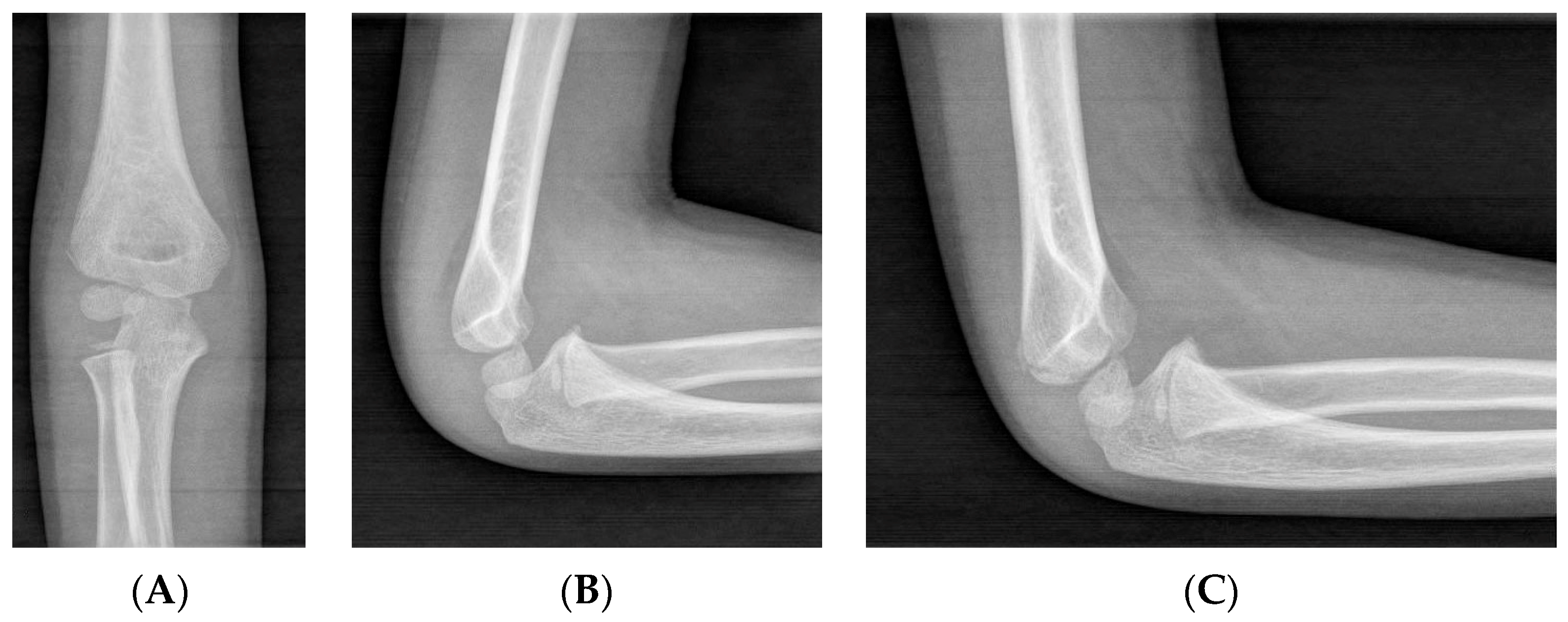 Children 11 01421 g001