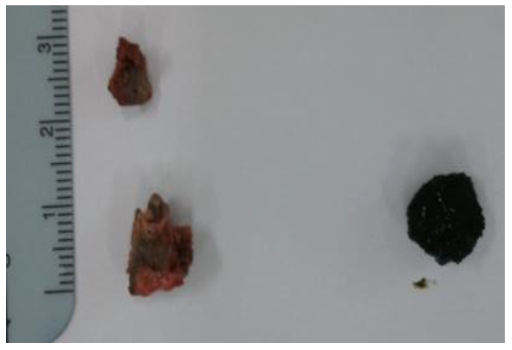 Children 11 01433 g004 Children 11 01433 g004