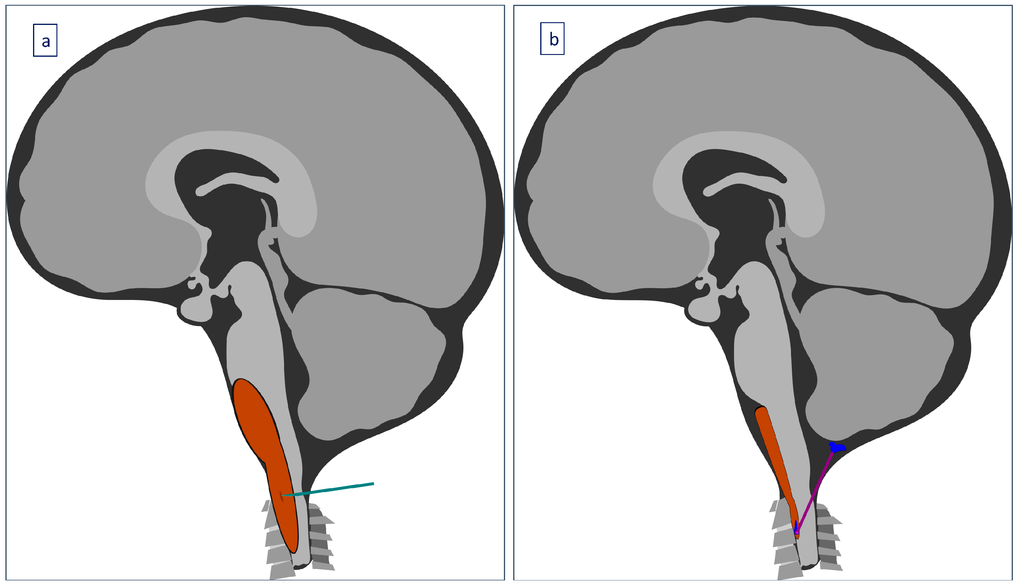 Children 11 01463 g004