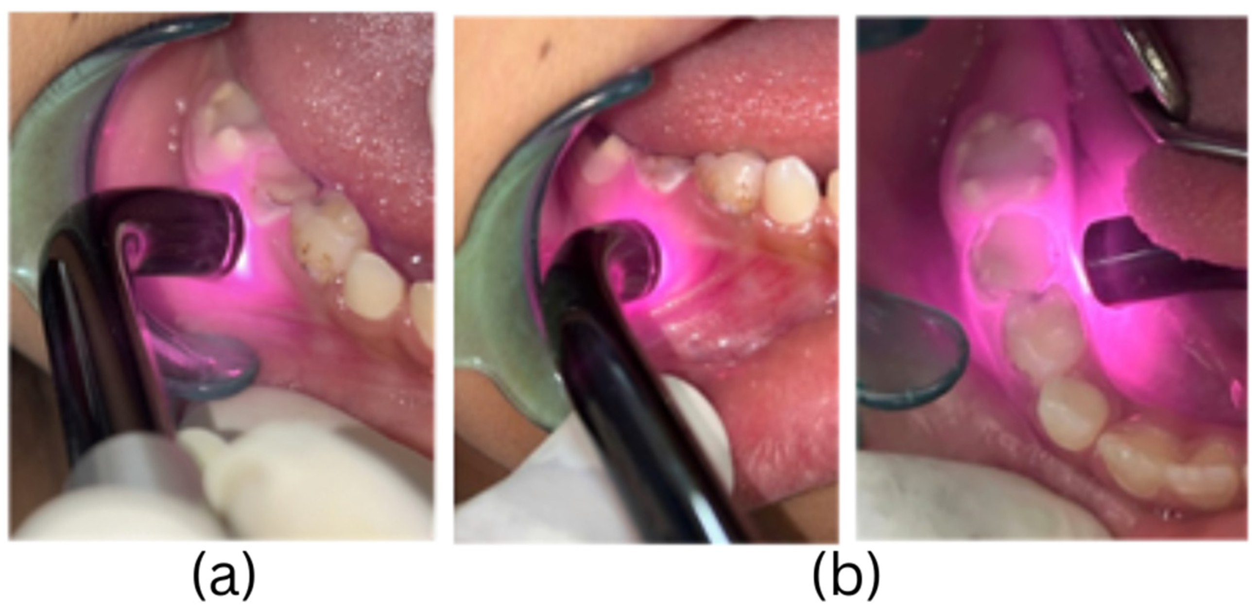 Children 11 01511 g002