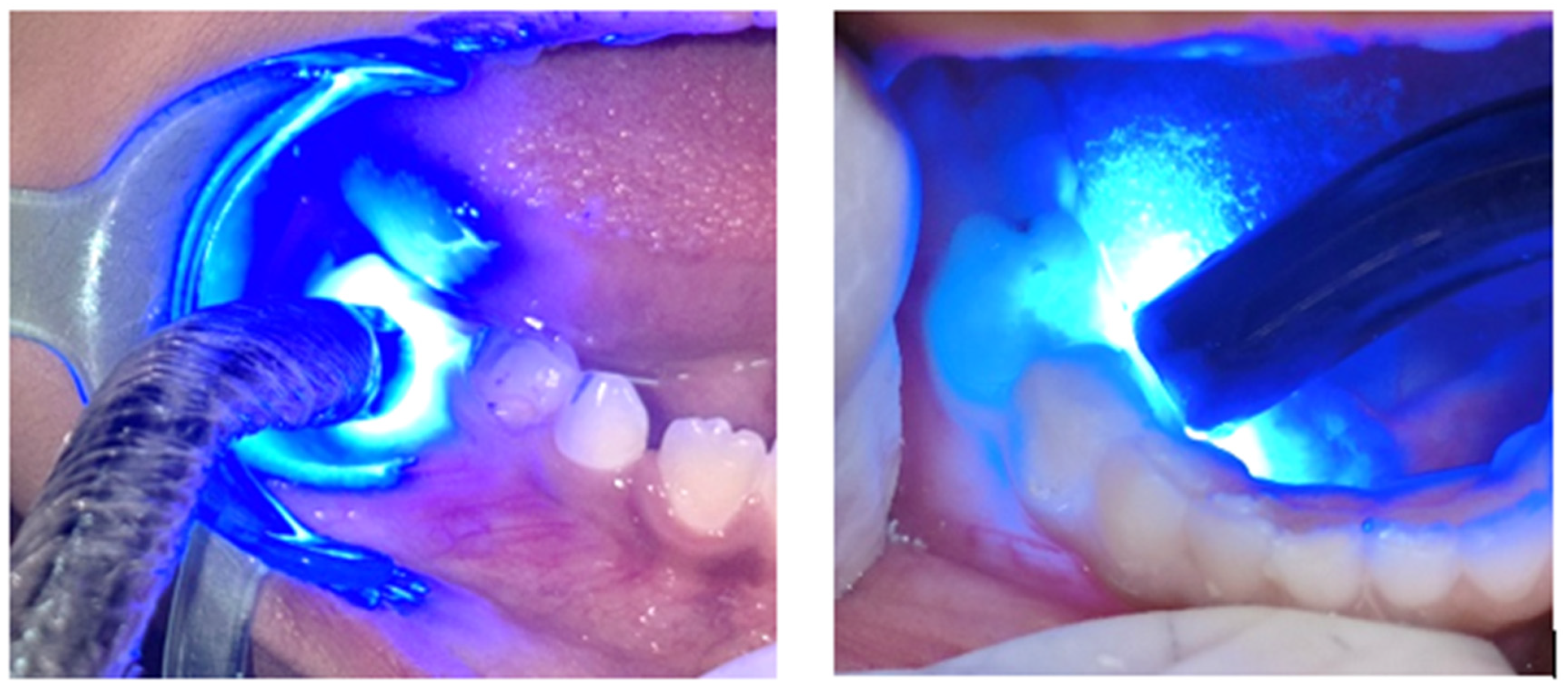 Children 11 01511 g003