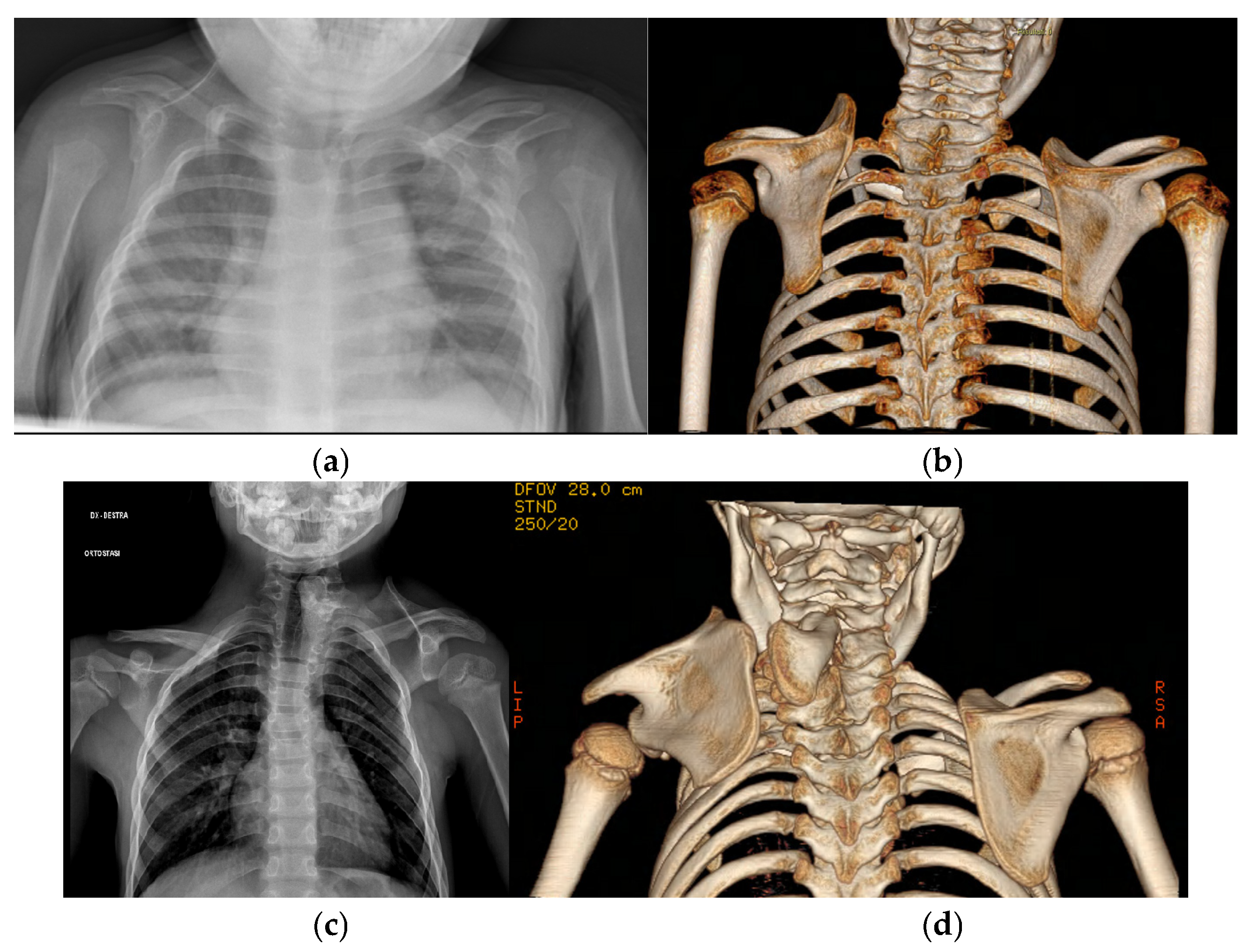 Children 12 00018 g002