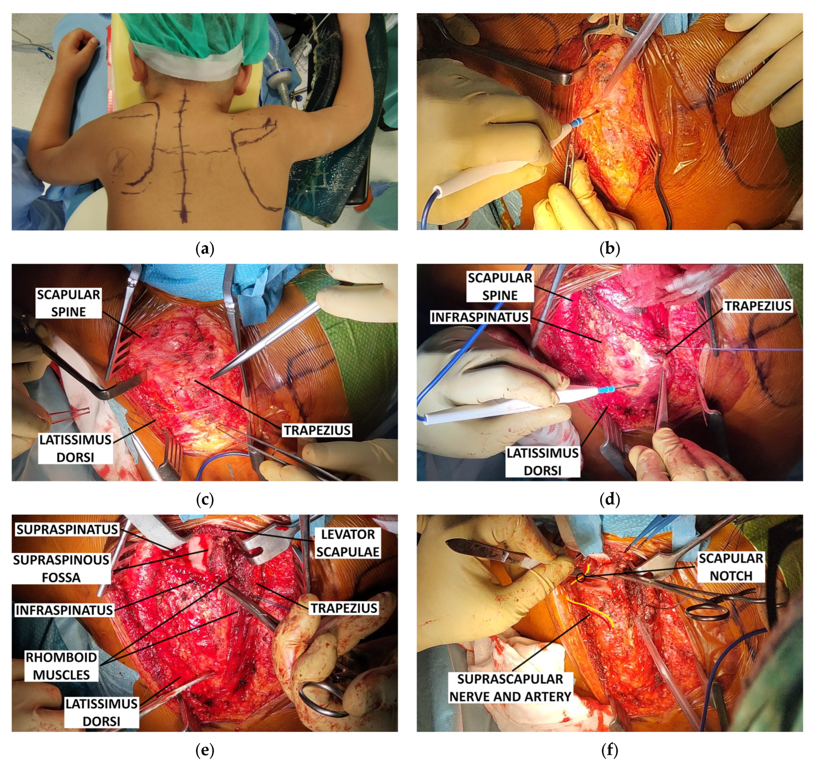 Children 12 00018 g003a