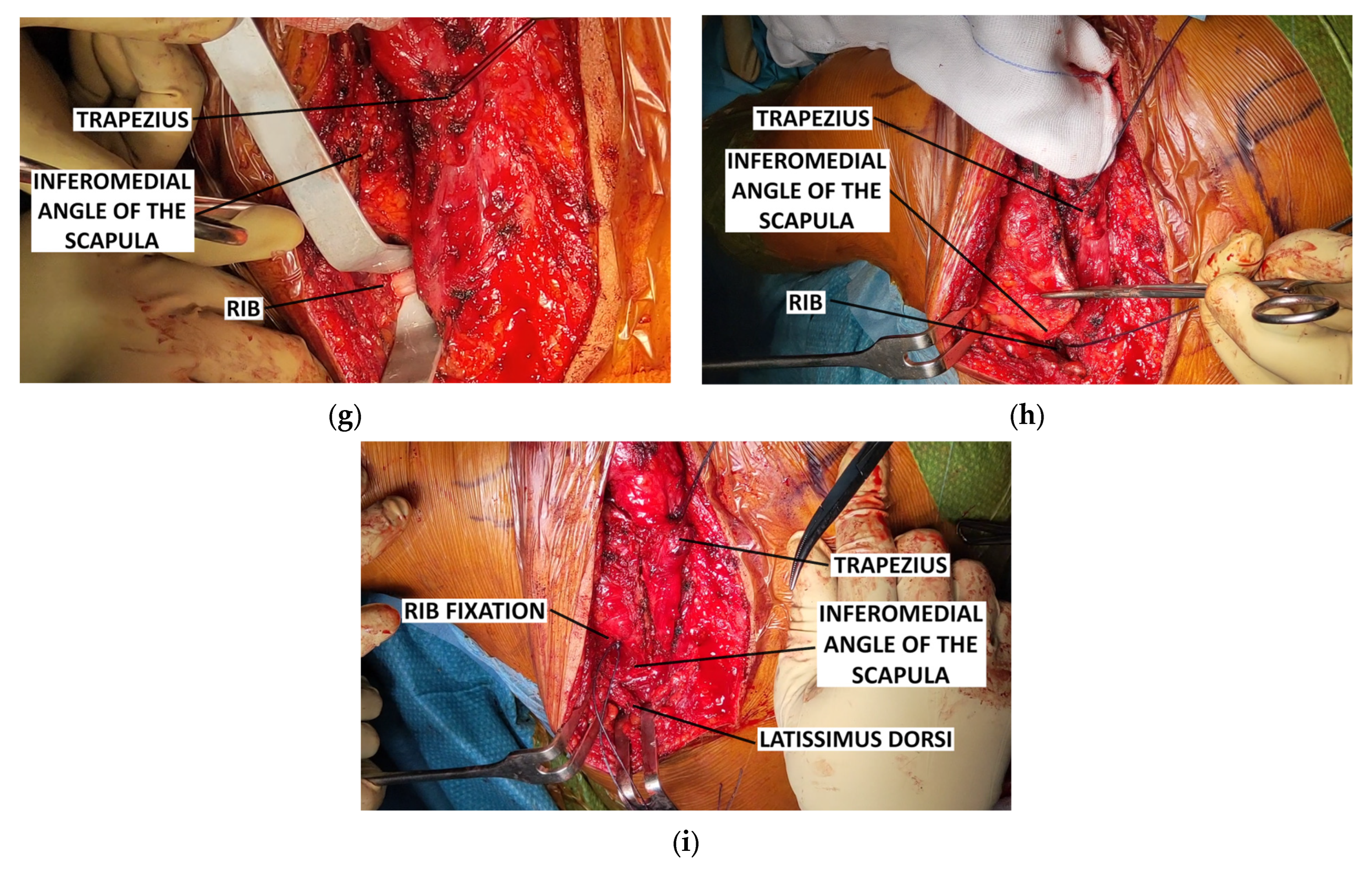 Children 12 00018 g003b