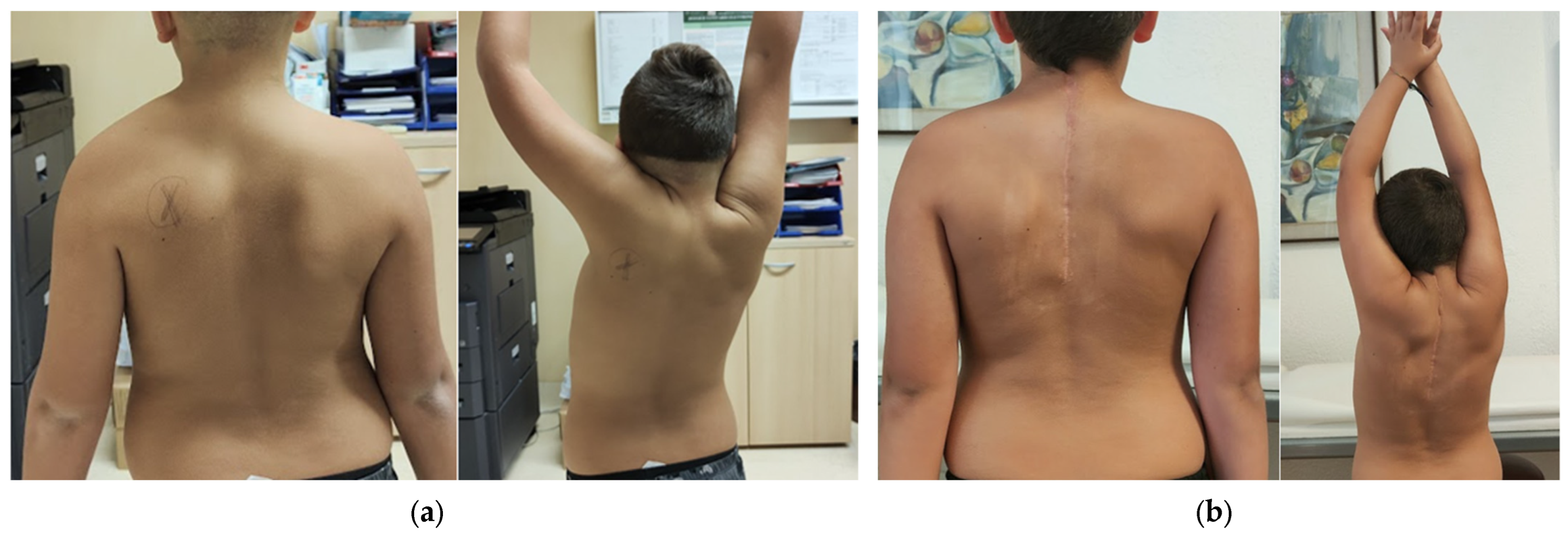 Children 12 00018 g005