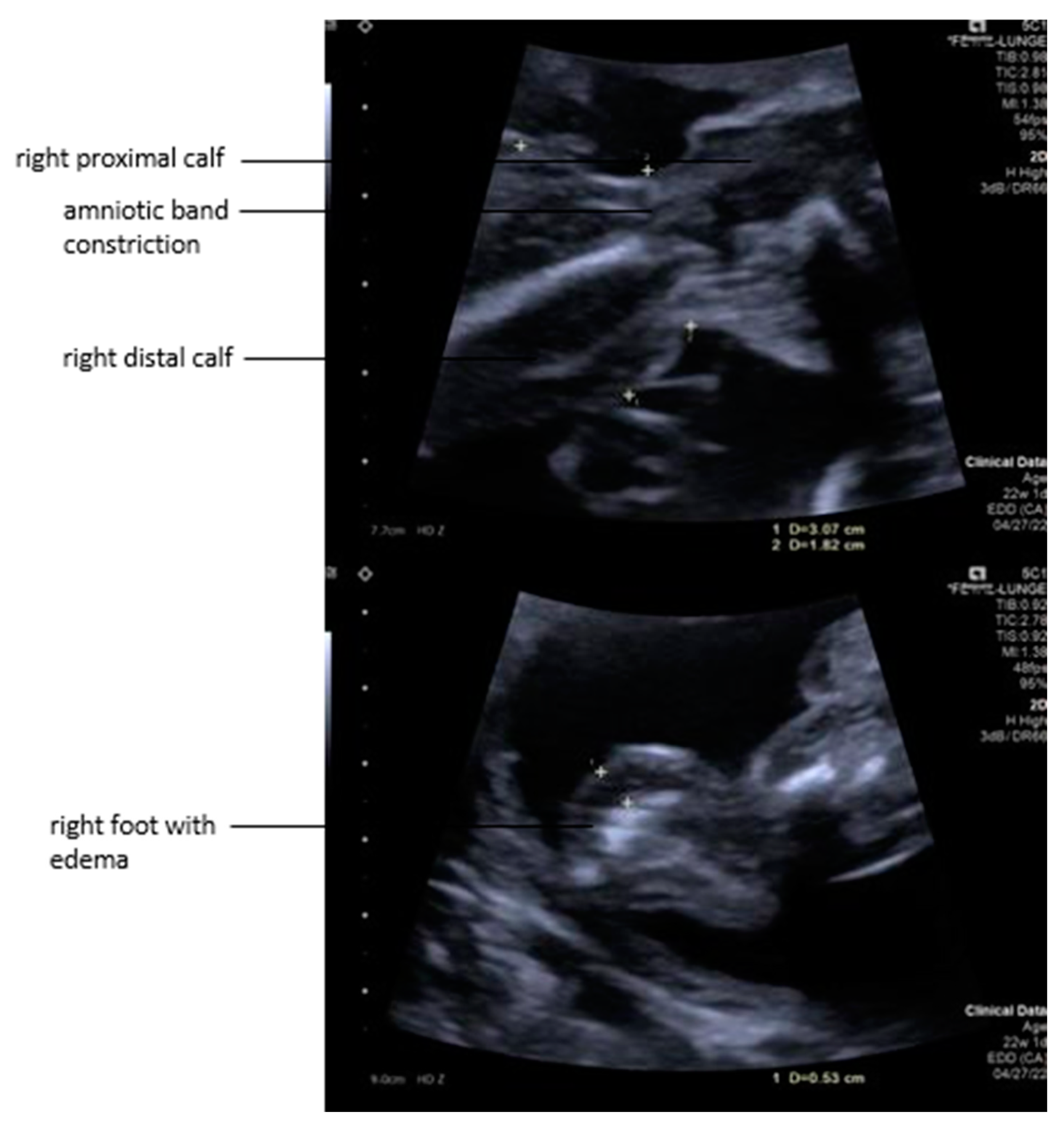 Children 12 00020 g002