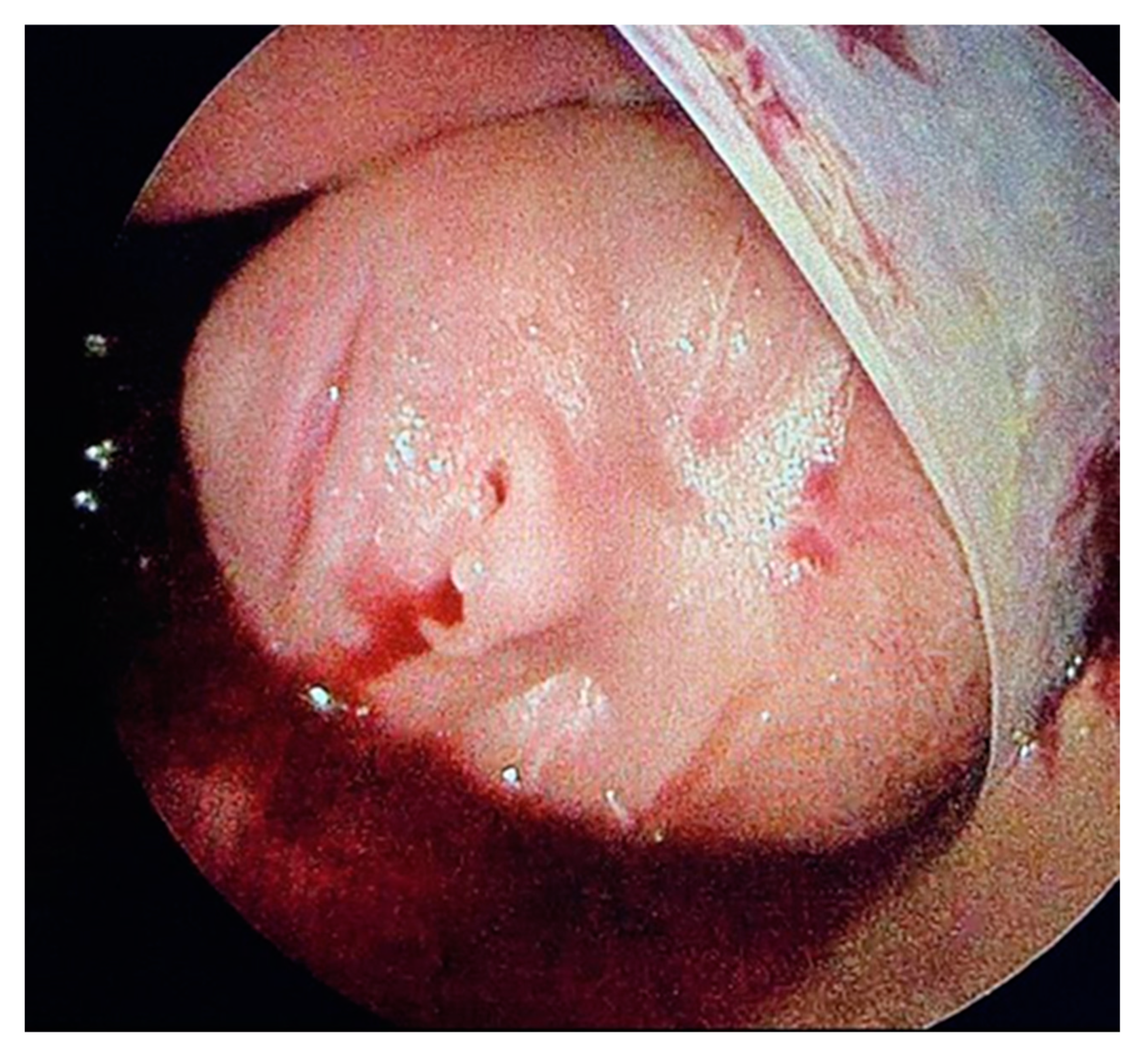 Children 12 00020 g003