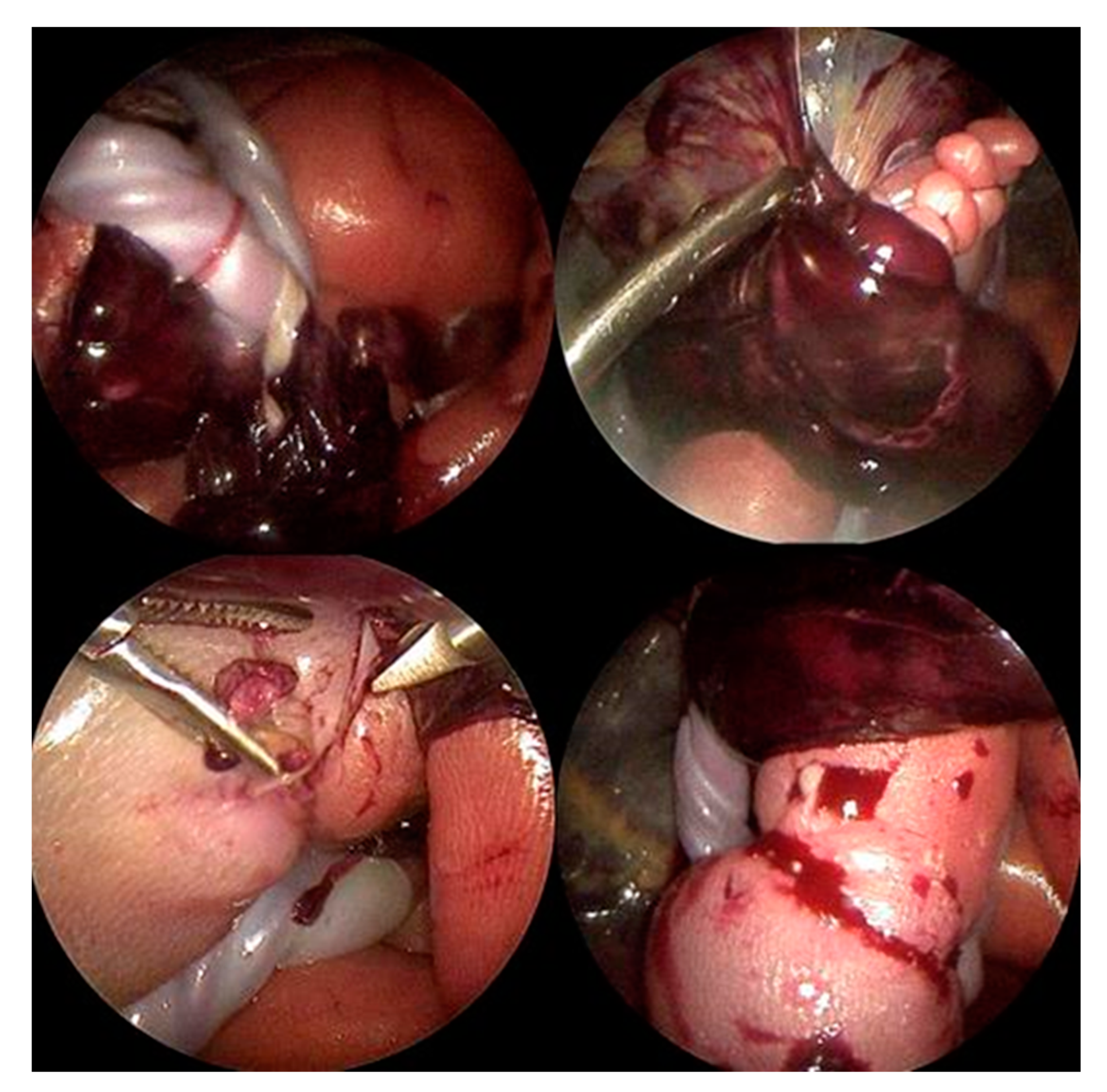 Children 12 00020 g004