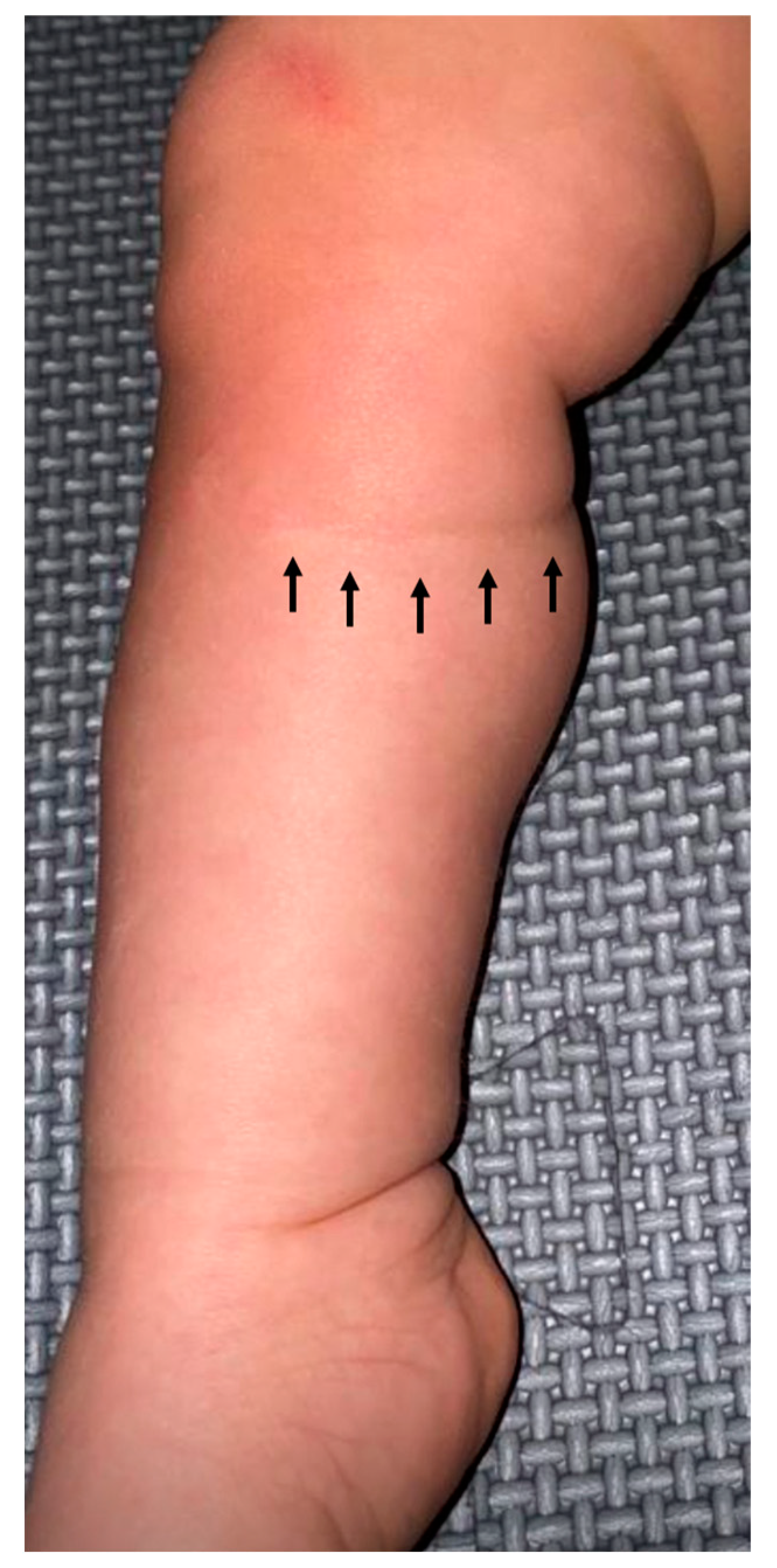 Children 12 00020 g005