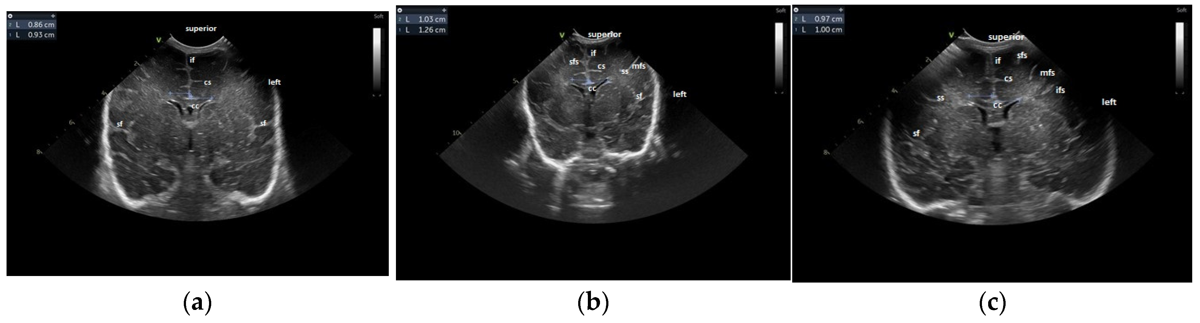 Children 12 00030 g001 Children 12 00030 g001