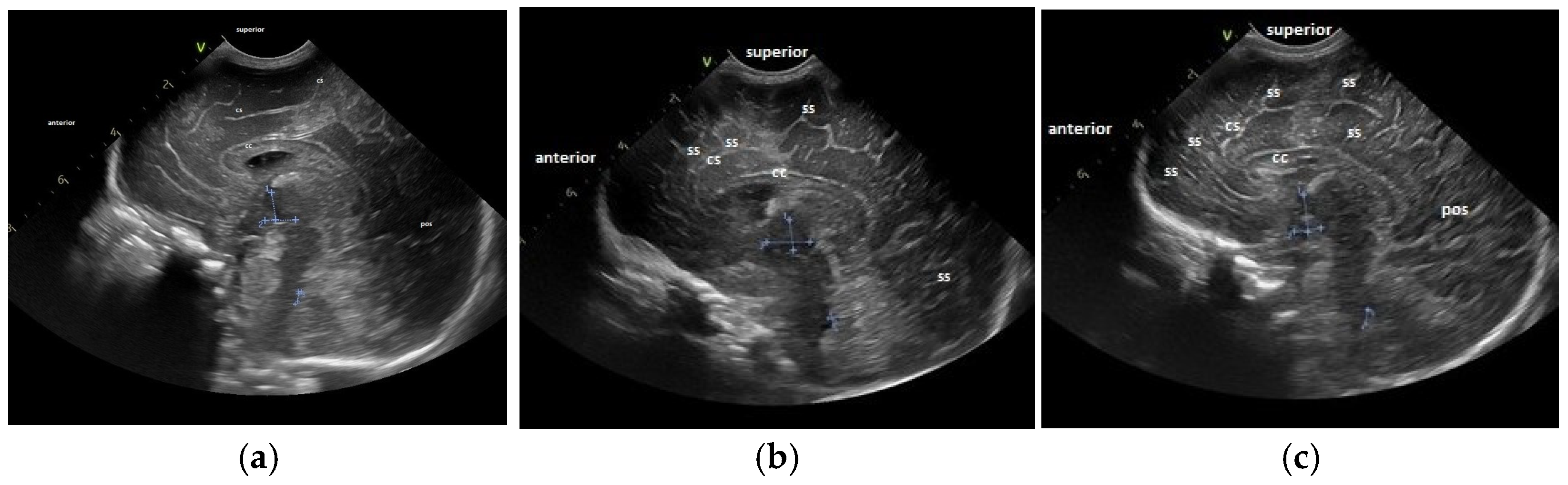 Children 12 00030 g002 Children 12 00030 g002