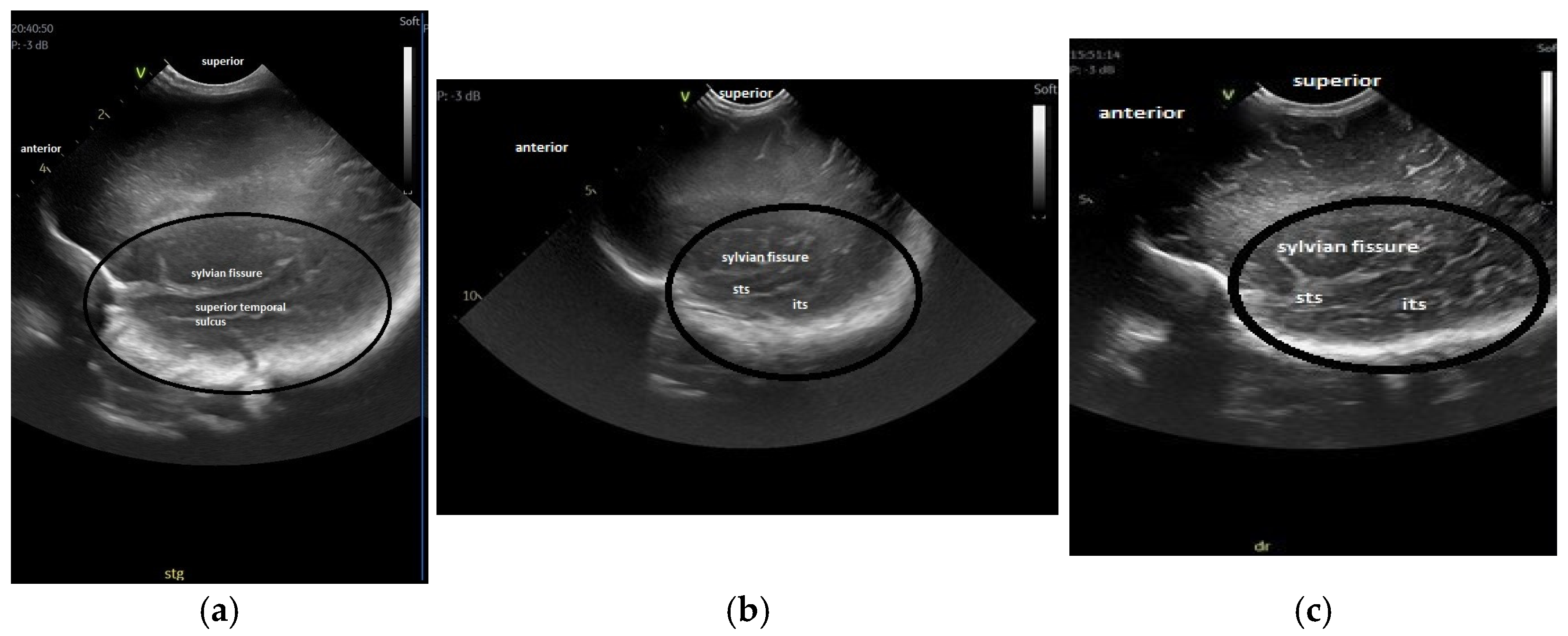 Children 12 00030 g003 Children 12 00030 g003