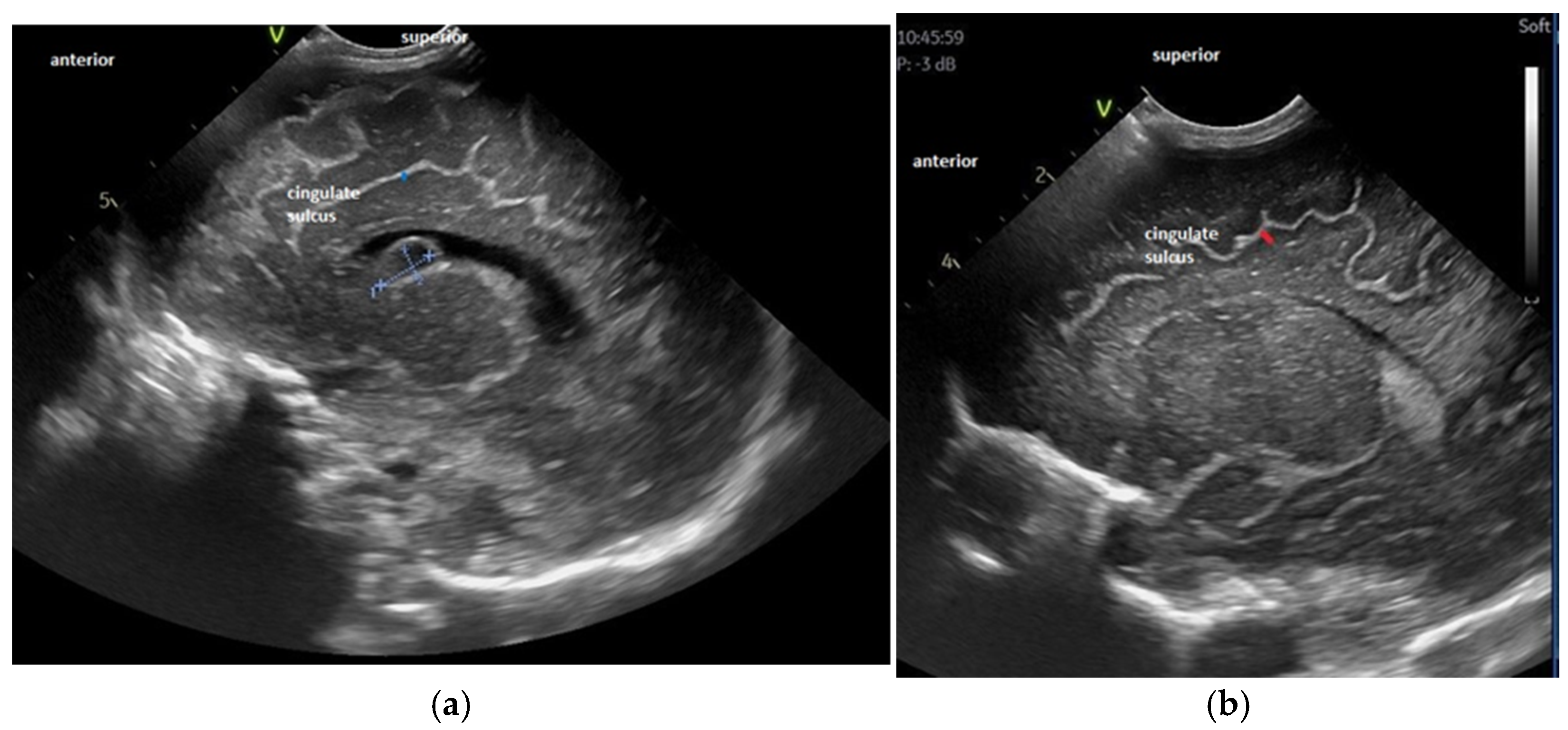 Children 12 00030 g004 Children 12 00030 g004