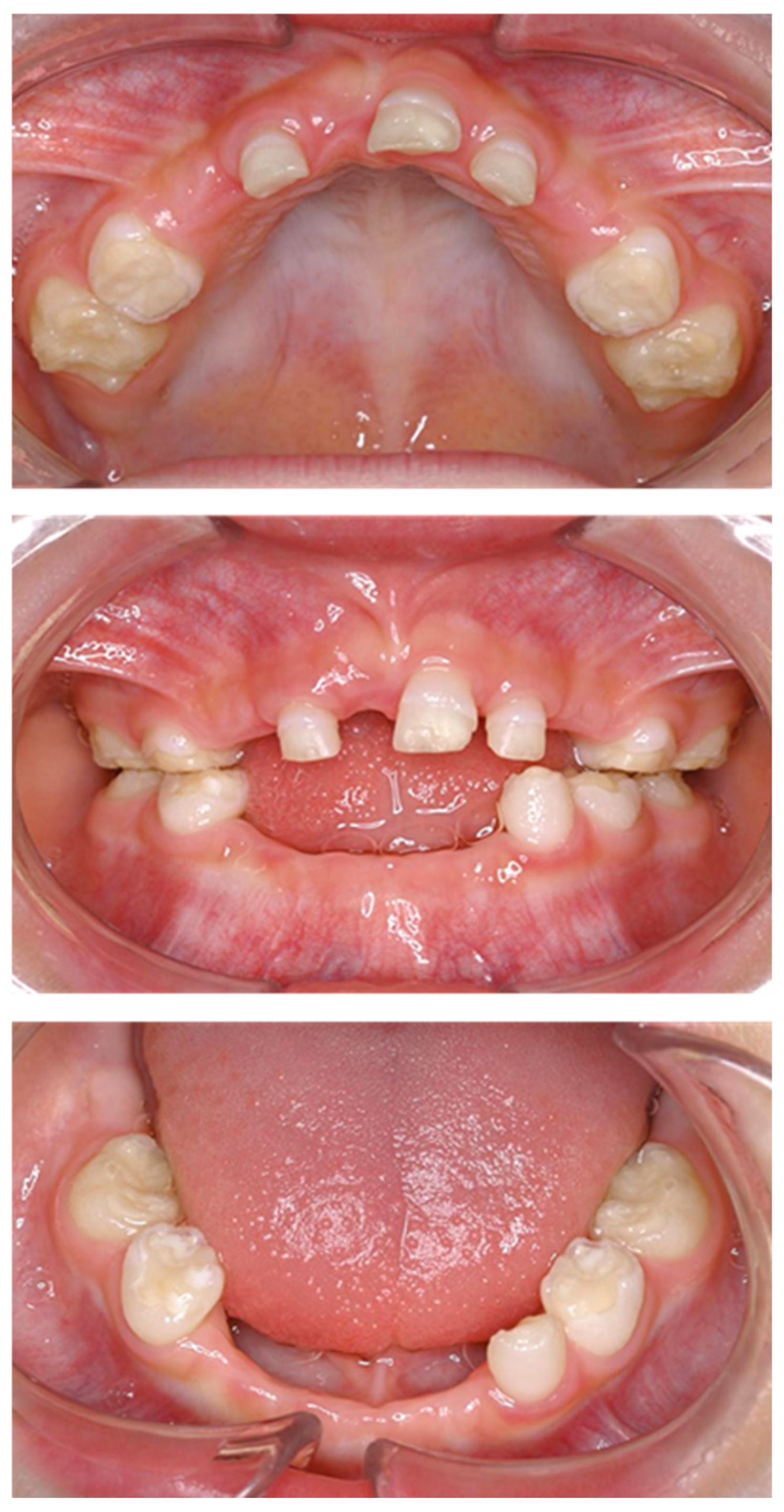 Children 12 00061 g002